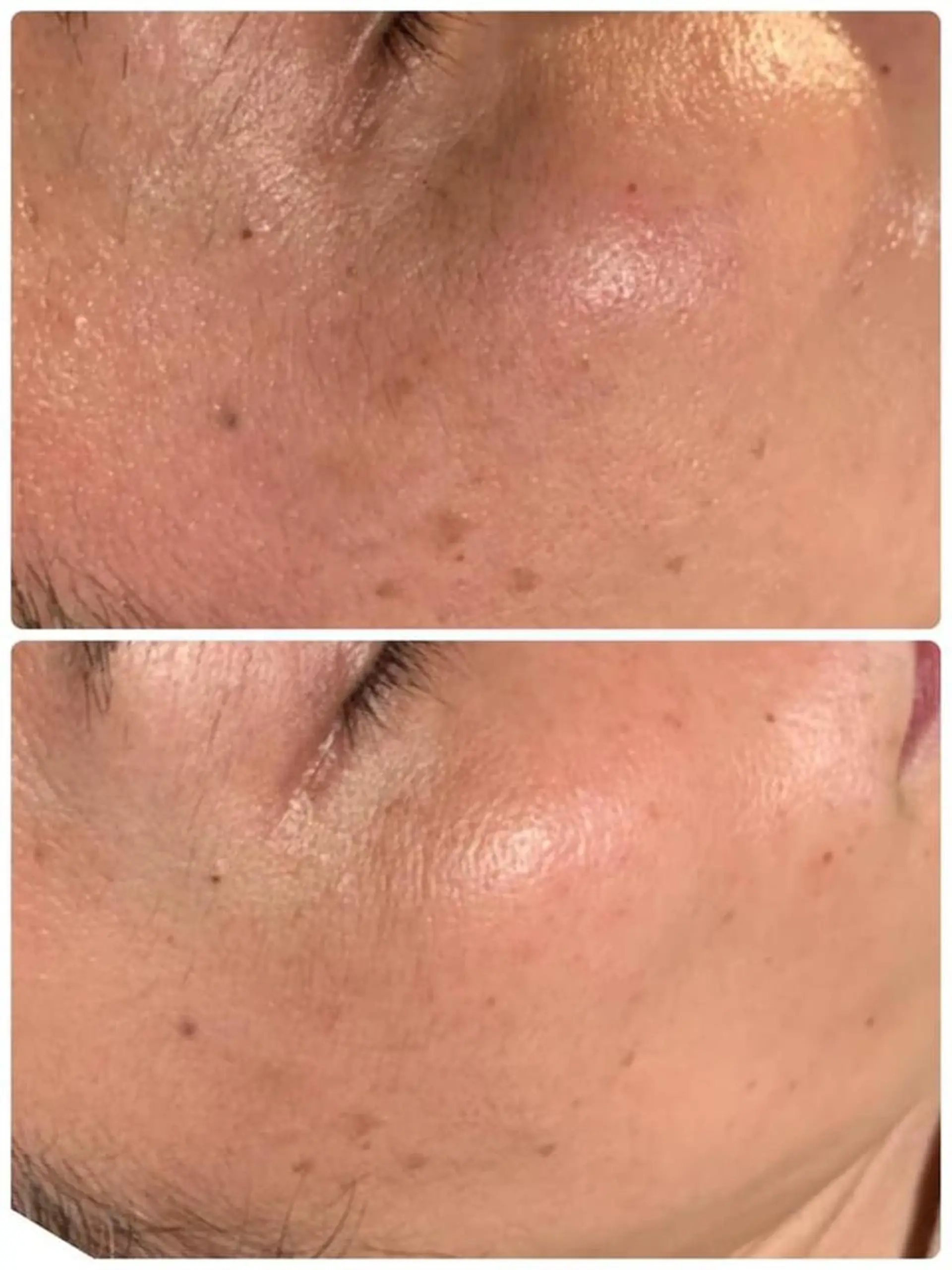 esty hitomiのエステ・リラクイメージ