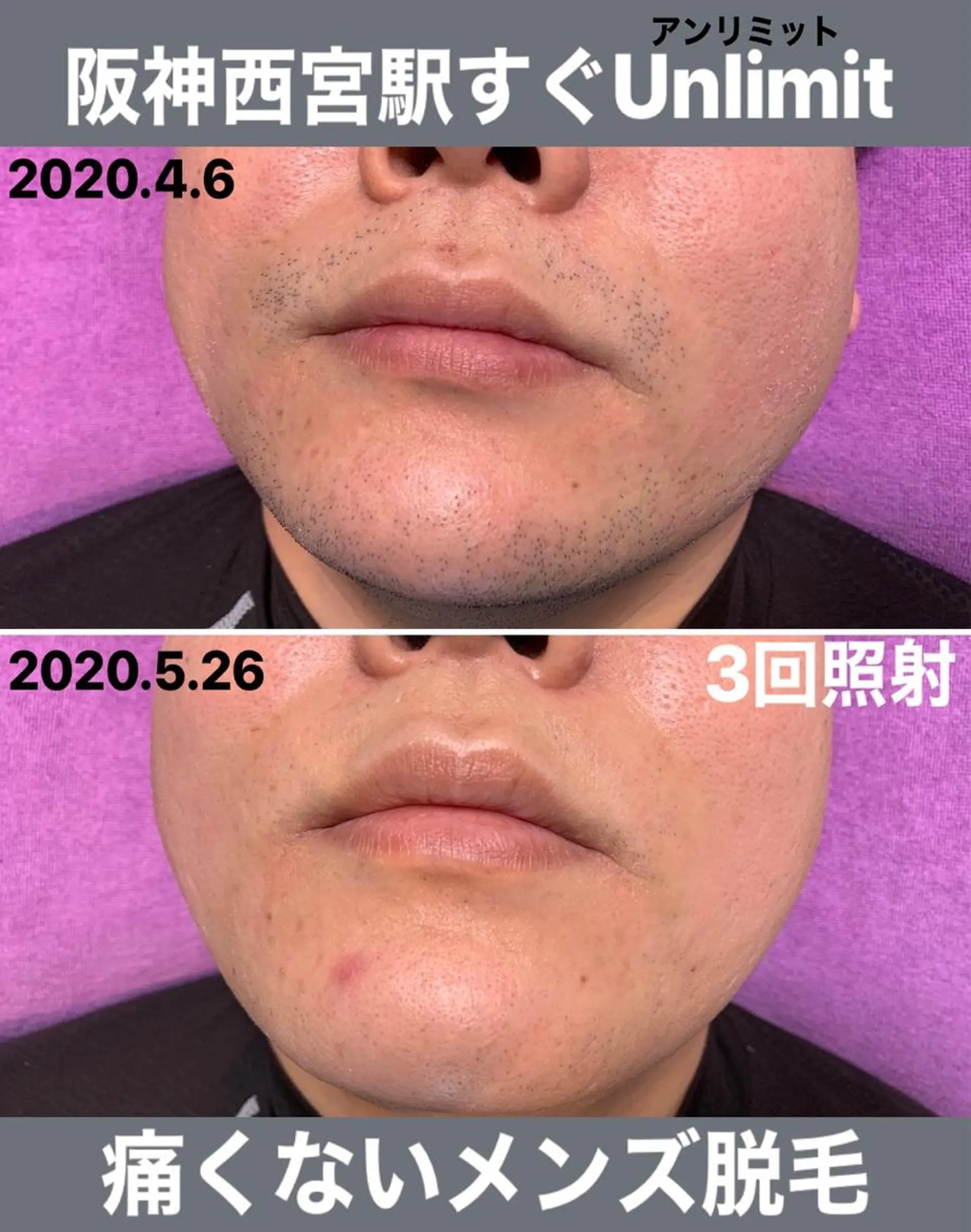 メンズ 脱毛＆エステサロン【アンリミット】所属・森谷 莉美のエステ・リラクイメージ