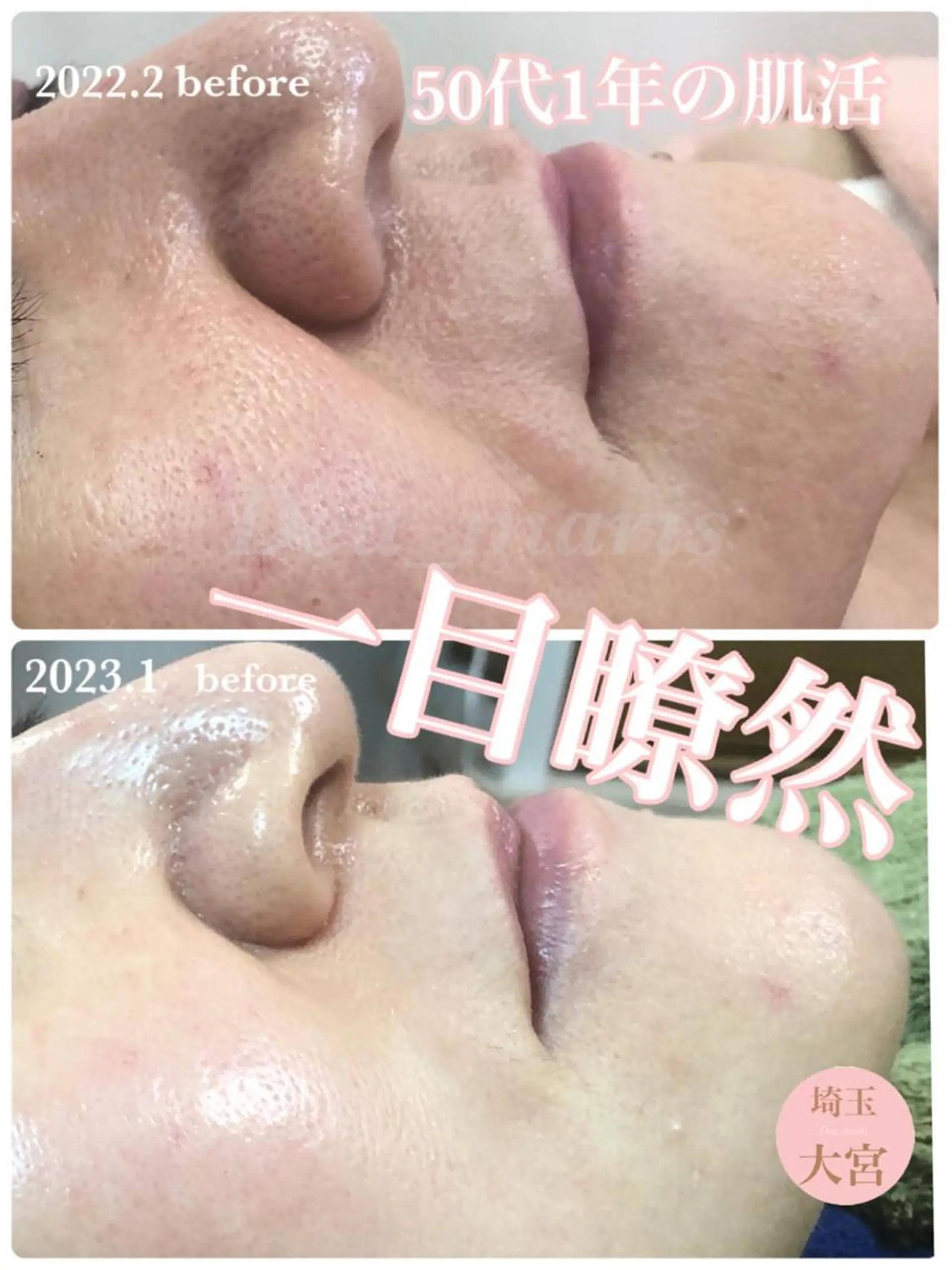 private salon Dea_maris シュガーリング&パーソナルボディケア所属・シミ改善・韓国肌管理 ボディメイク痩身のその他イメージ