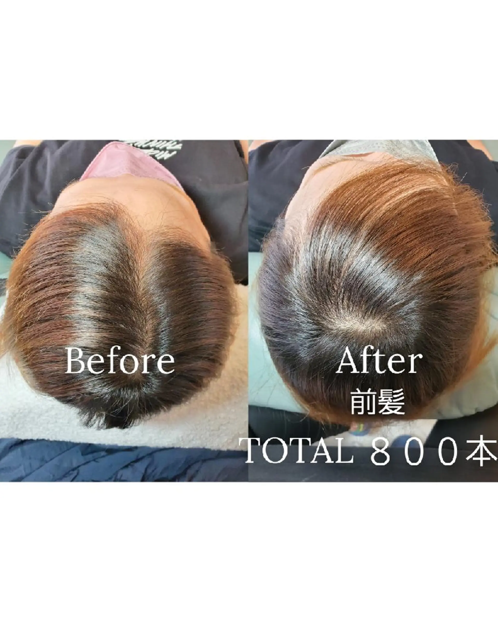 歯科提携セルフダック 宇都宮駒生店のエステ・リラクイメージ