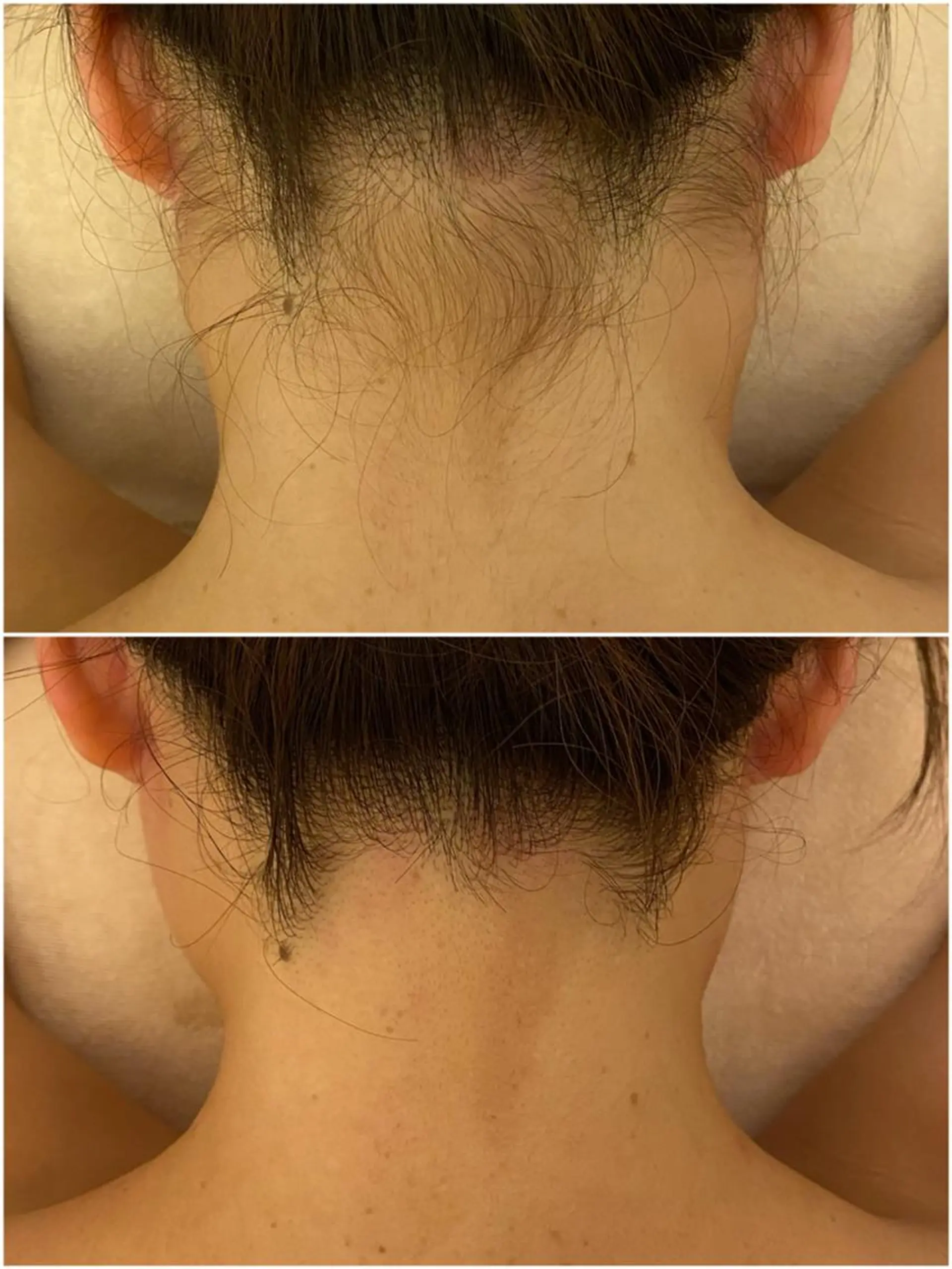 ✨美肌水光✨ アトリエリュバンのエステ・リラクイメージ