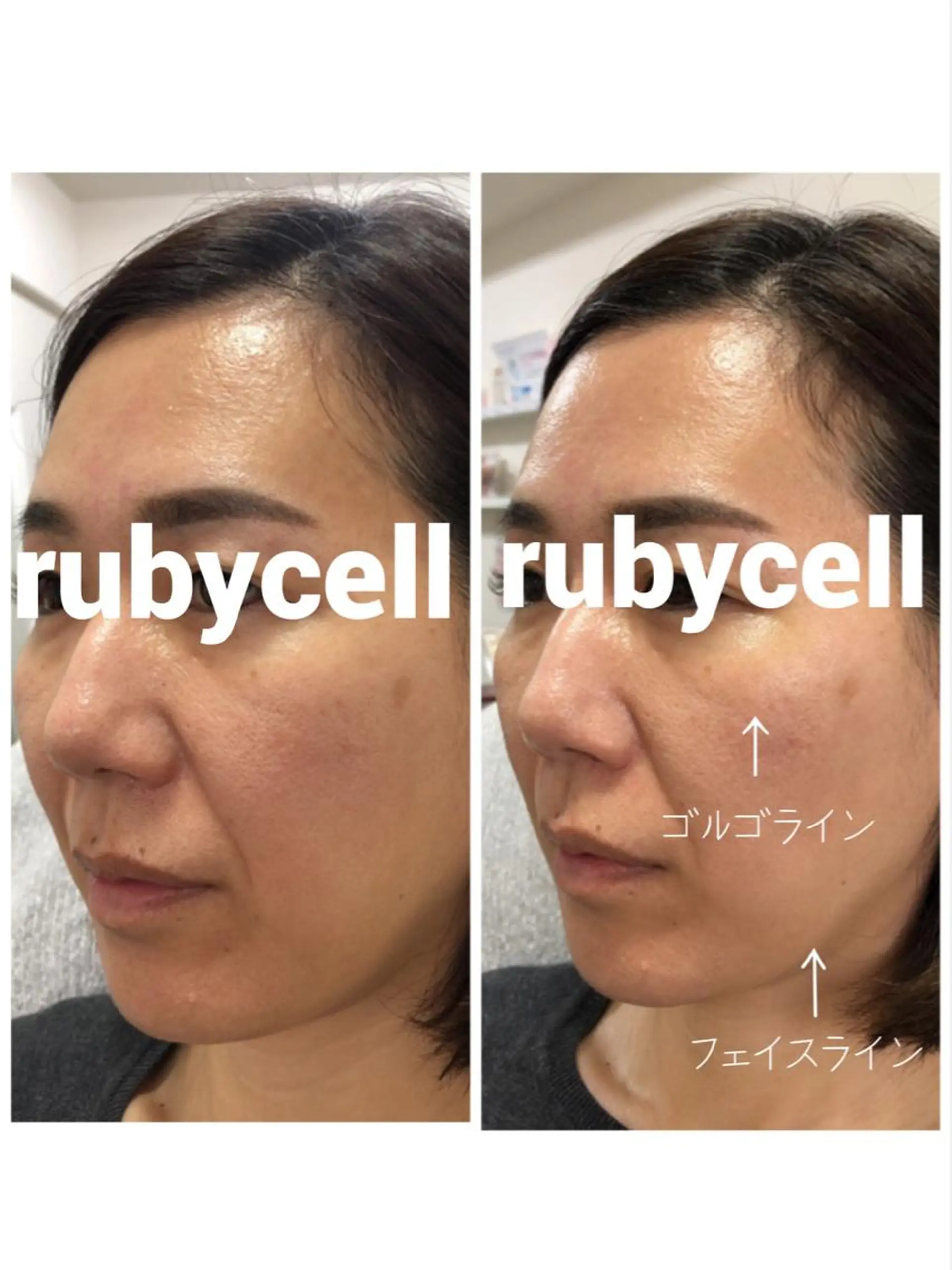 ruby cell hue.のその他イメージ