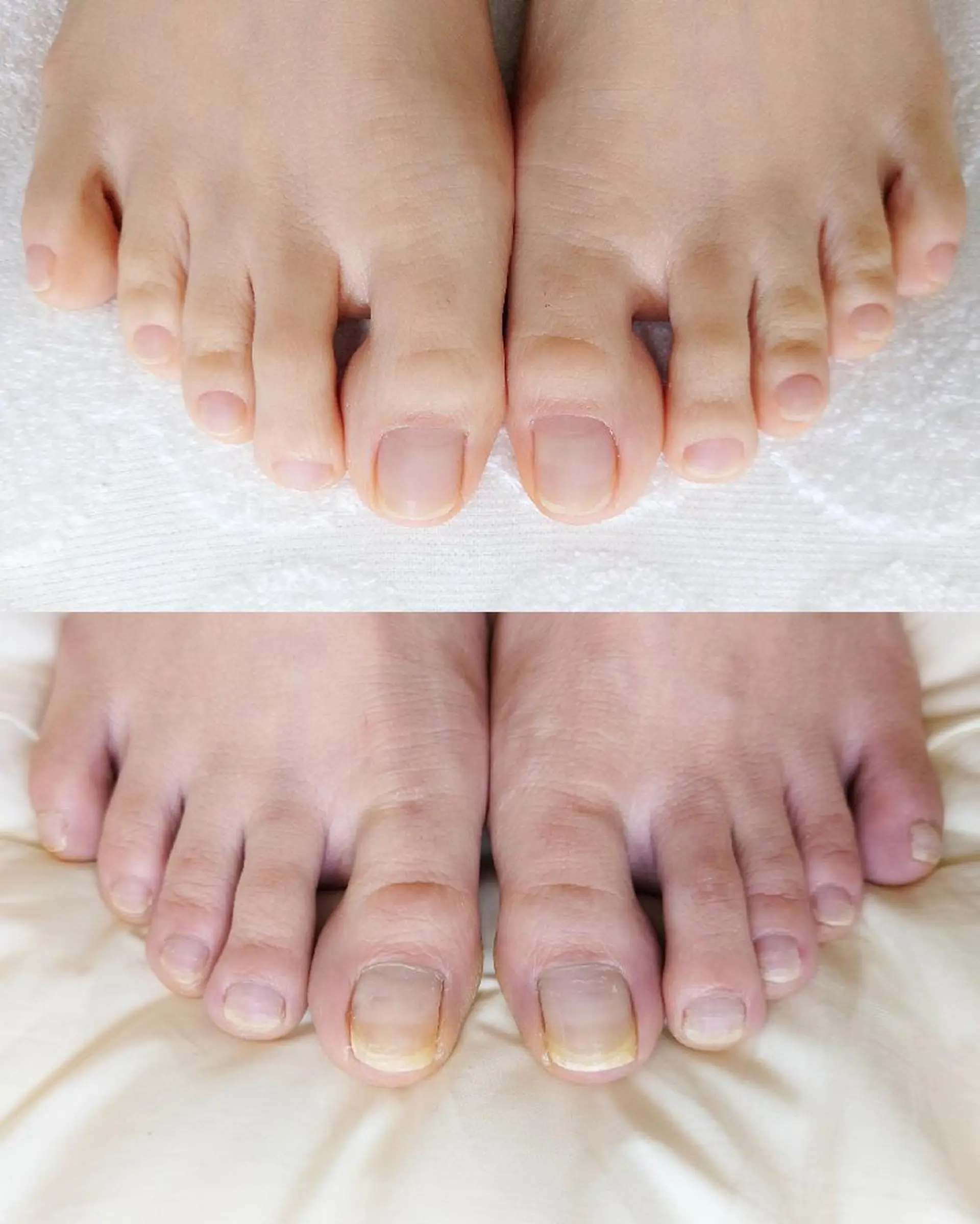 ネイル ショート improve /mamiのネイルデザイン