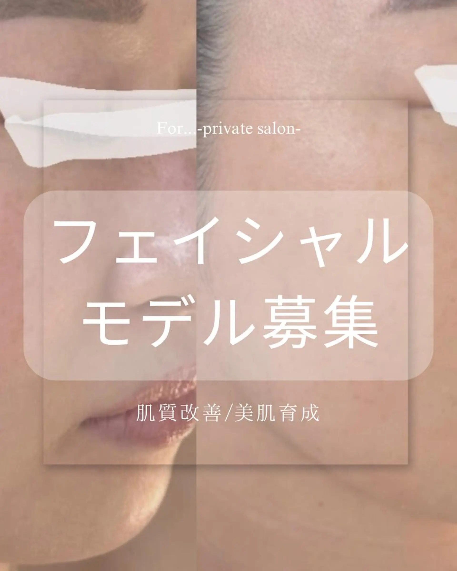 エステ 肌質改善|天王寺 For...はるかのエステ・リラクイメージ