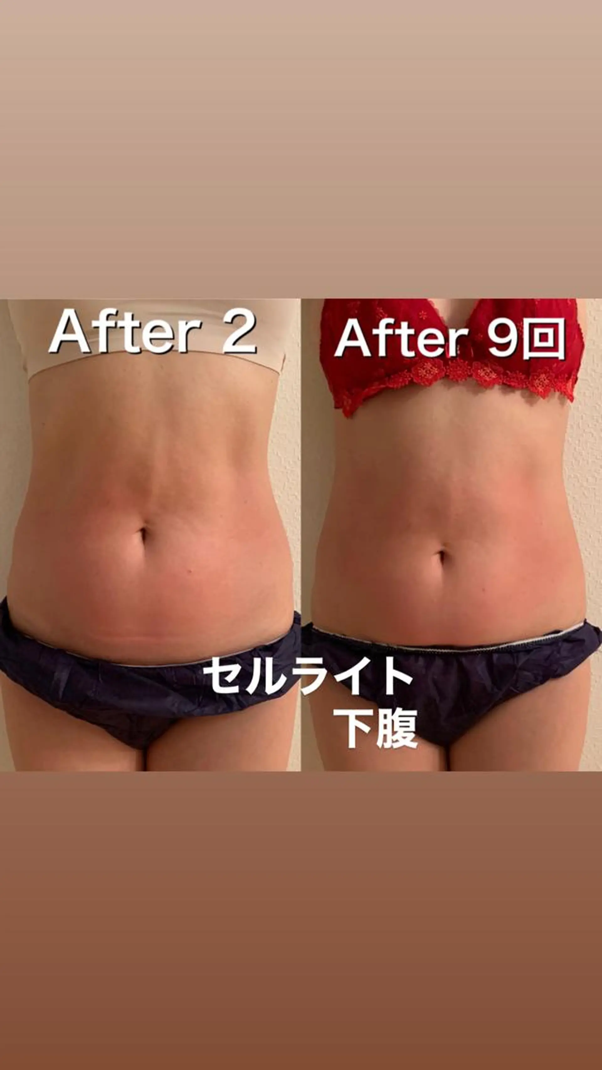 【ハイパーナイフ痩身&小顔コルギ&ハーブピーリング】K-Beauty　東新宿所属・kーbeauty痩身 フェイシャルのエステ・リラクイメージ