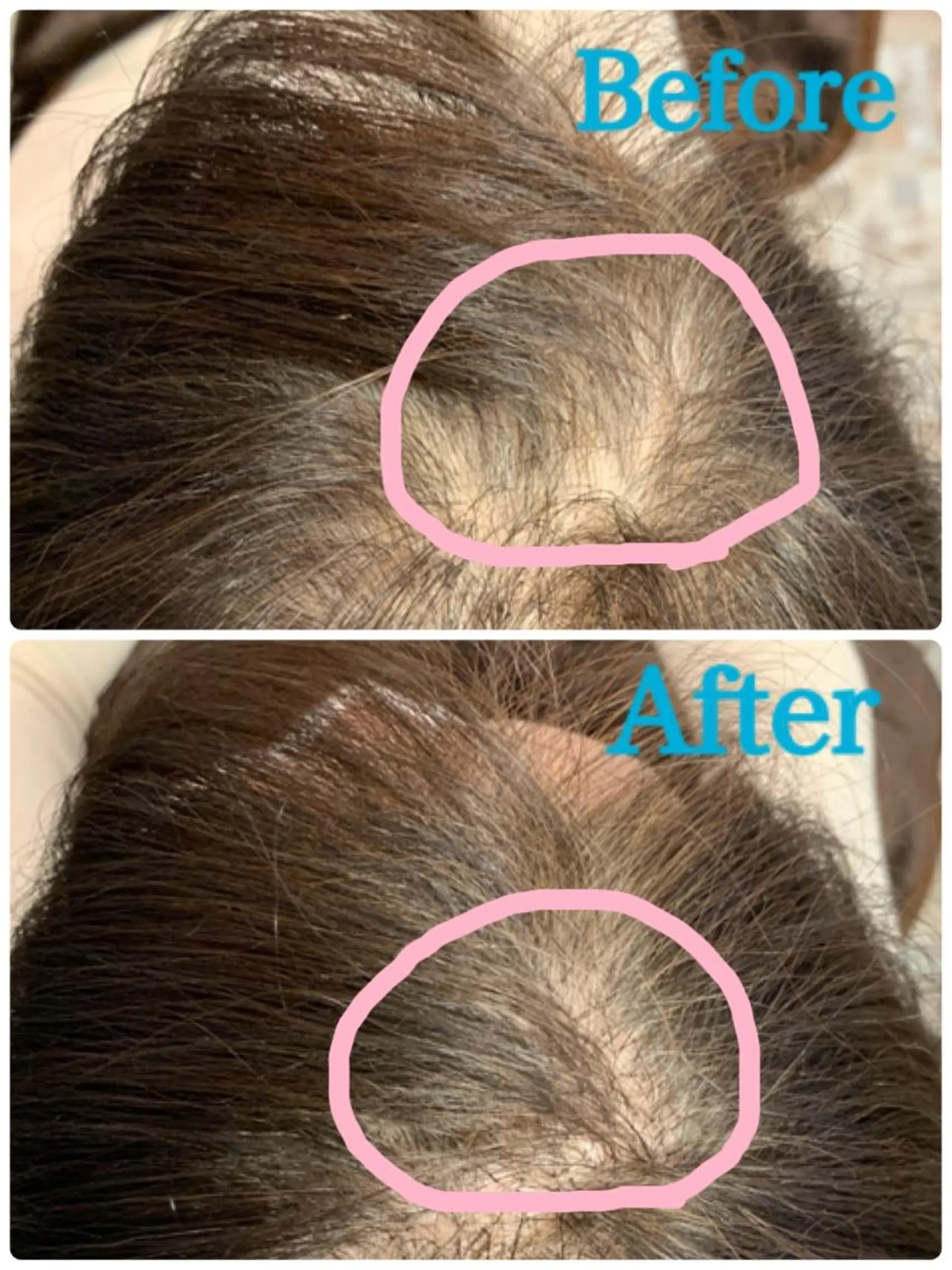 ヘアアレンジ Kanal Kanaのエステ・リラクイメージ