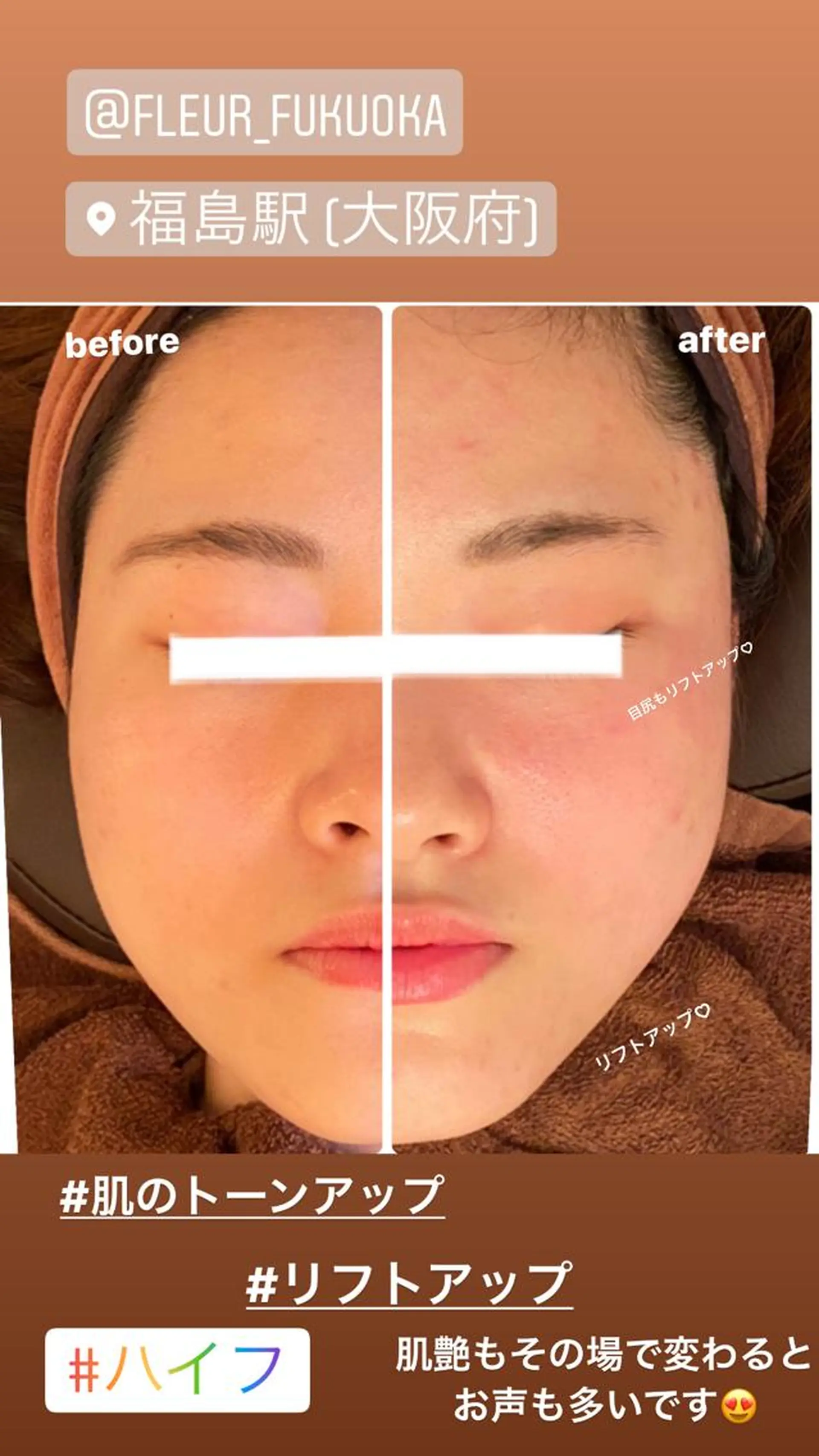 FLEUR大阪・整体 ・ハイフ・痩身・小顔のエステ・リラクイメージ