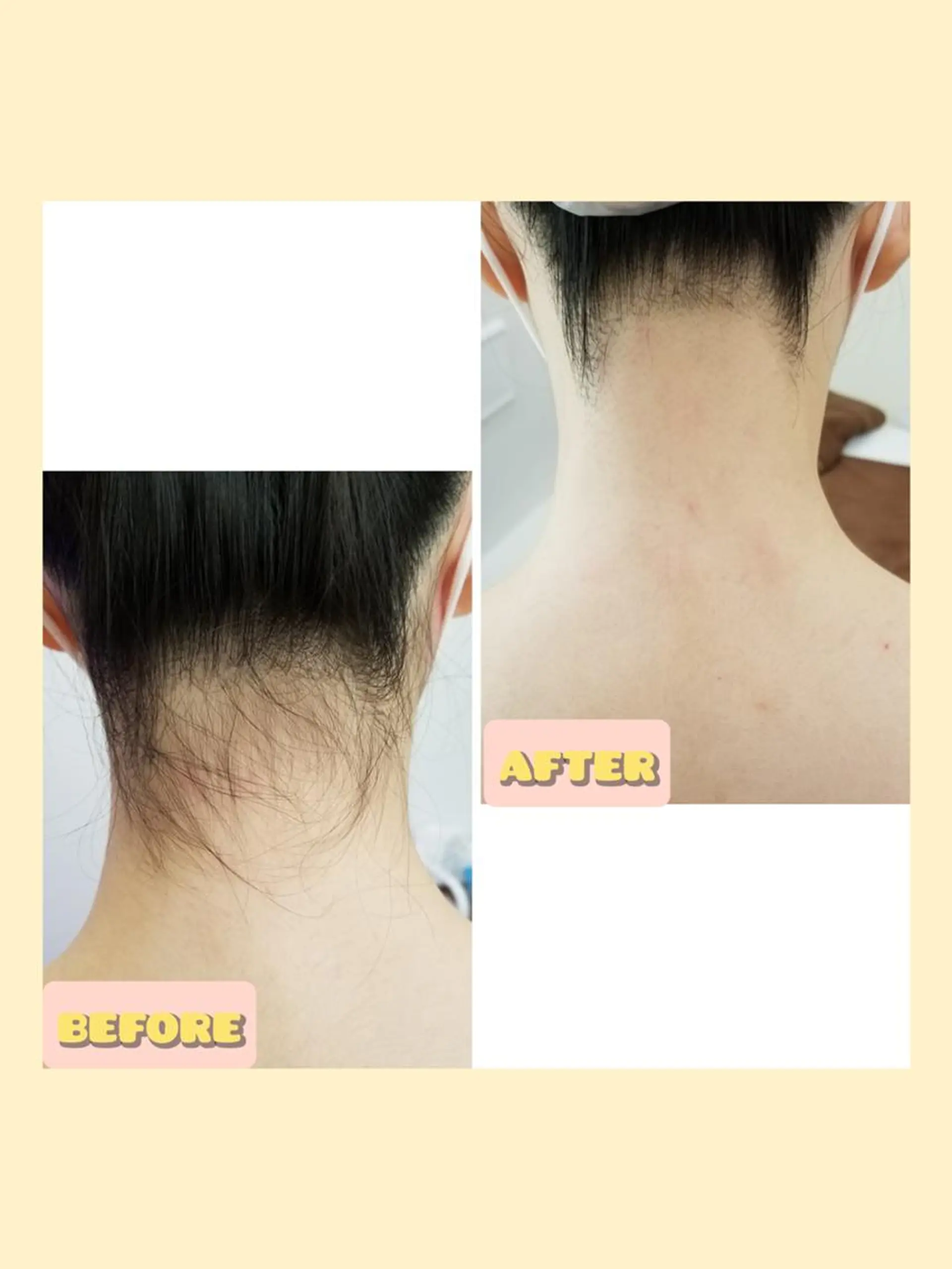 脱毛 salonde ReGodのエステ・リラクイメージ