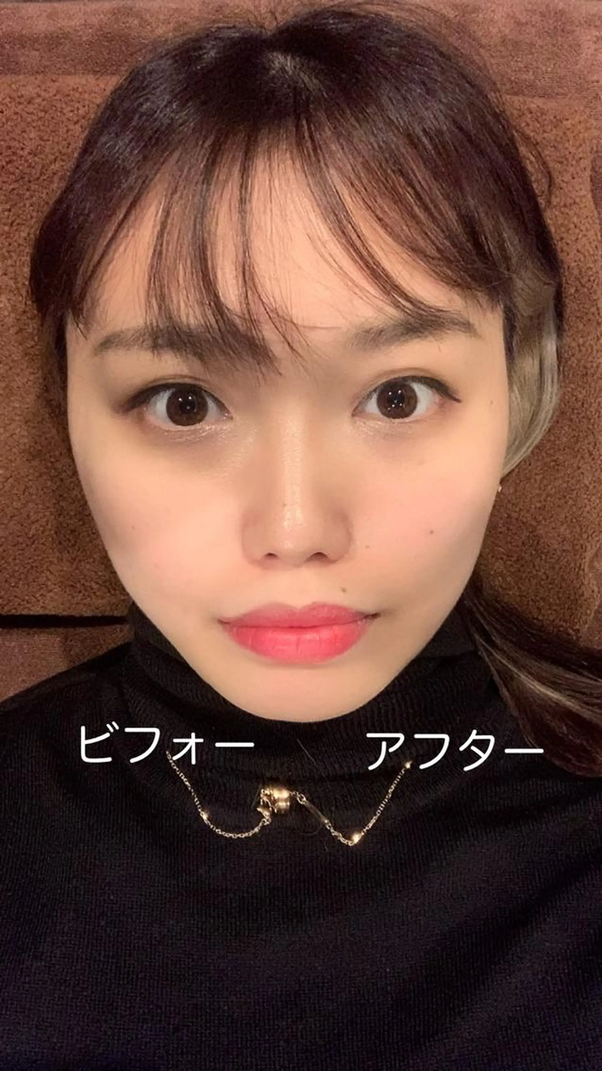 メンズ エステ リラク 美容鍼灸サロン LOMIHARIのエステ・リラクイメージ