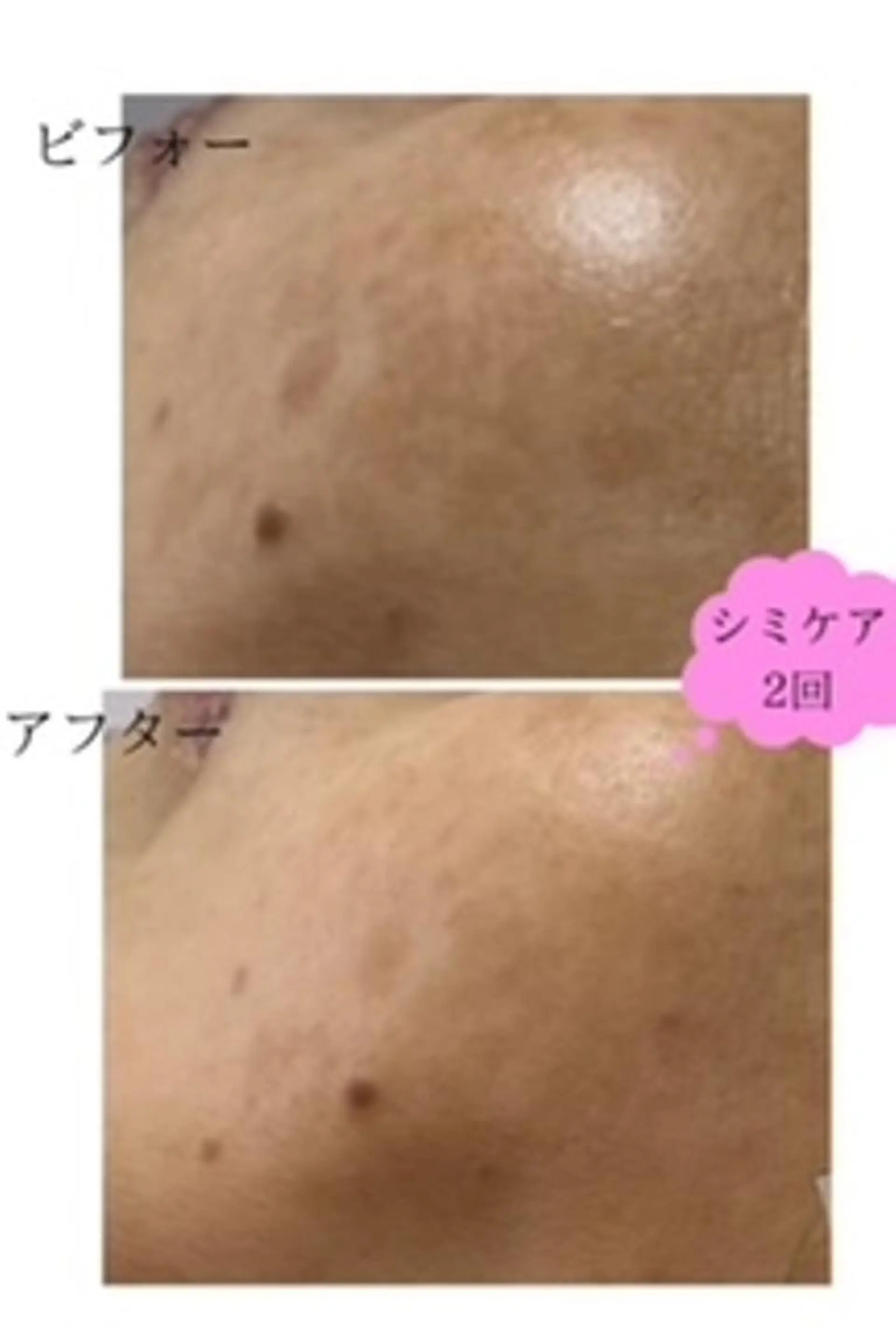 エステ Lien オーナー　山口智嘉のエステ・リラクイメージ