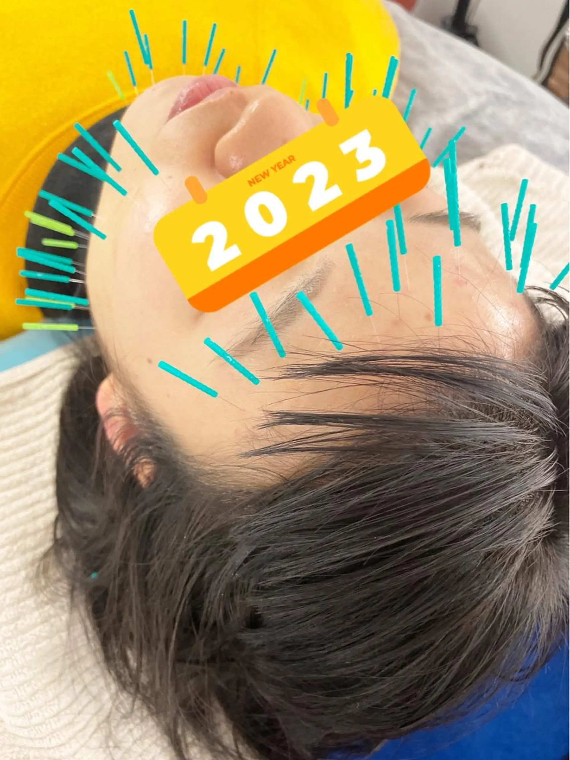 エステ リラク 小顔美容鍼専門サロン 渋谷YZのエステ・リラクイメージ