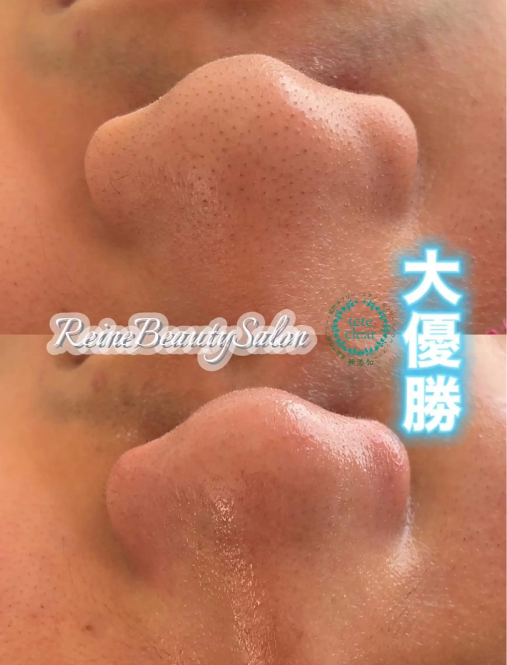 エステ Reine BeautySalon所属・毛穴/シミ肝斑/脱毛 横山梨里のエステ・リラクイメージ