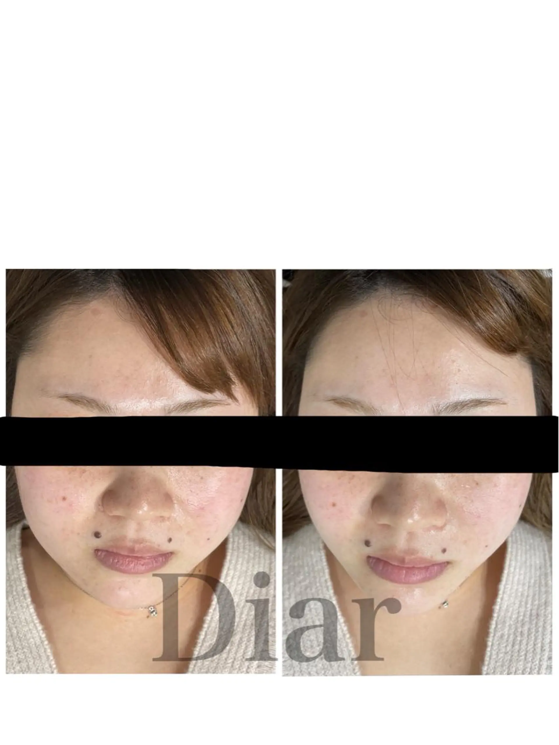 Diar salonのエステ・リラクイメージ