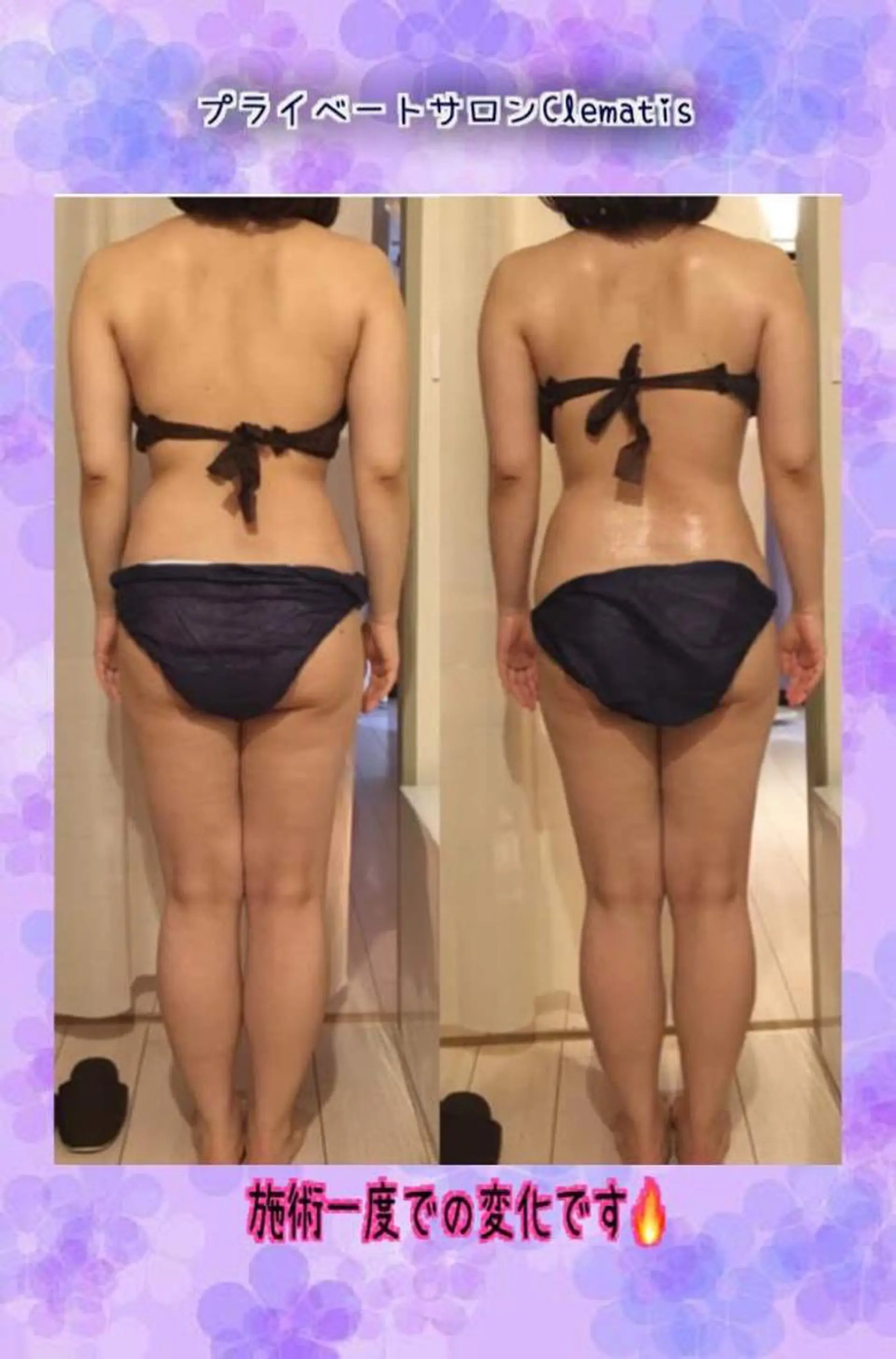 ショート カラー パーマ ヘアアレンジ メンズ キッズ ネイル マツエク・マツパ 強圧オールハンド痩身&黄土よもぎ蒸しプライベートサロンClematis池袋所属・強圧オールハンド痩身 片野のエステ・リラクイメージ