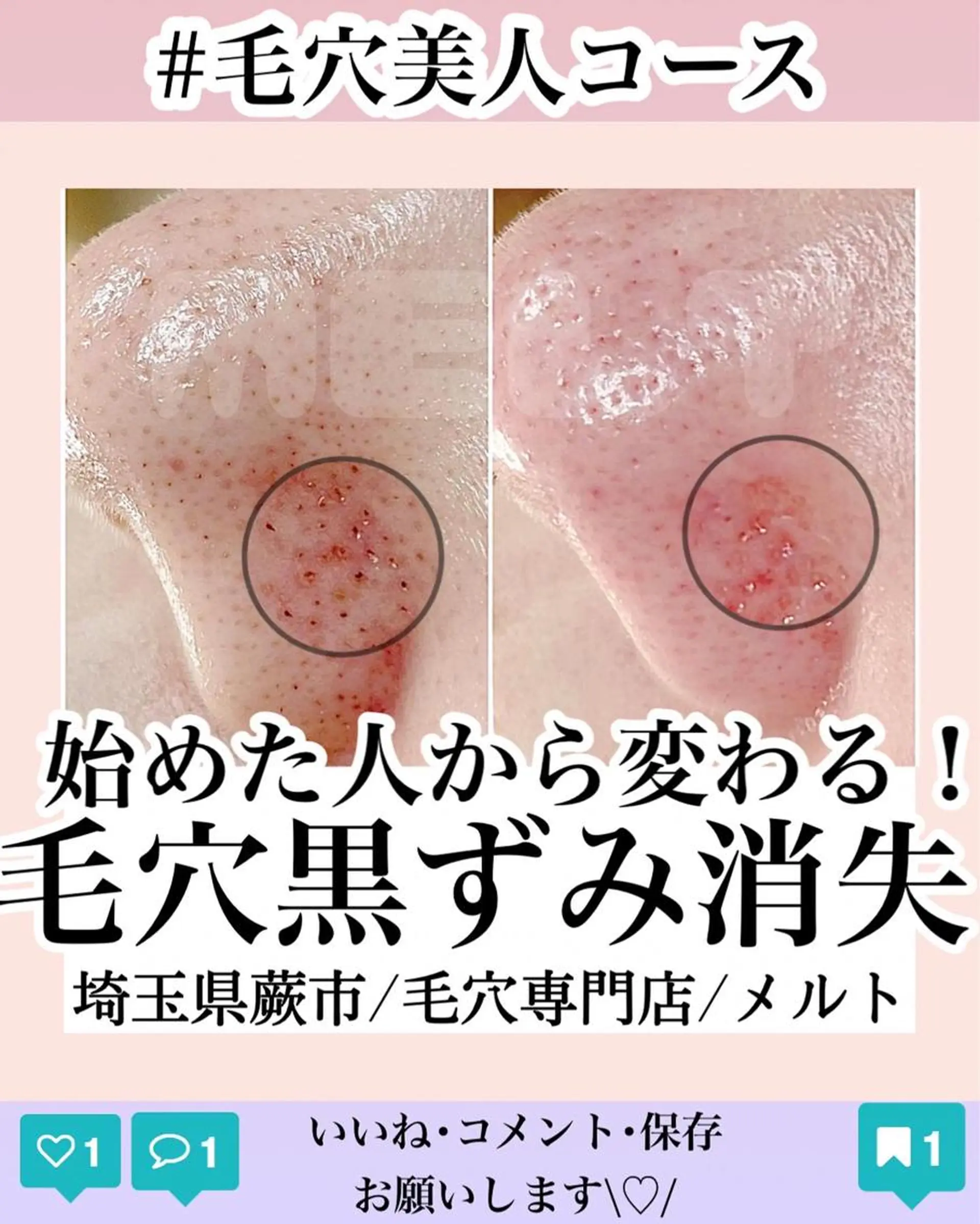 melt まみのマツエク・マツパデザイン