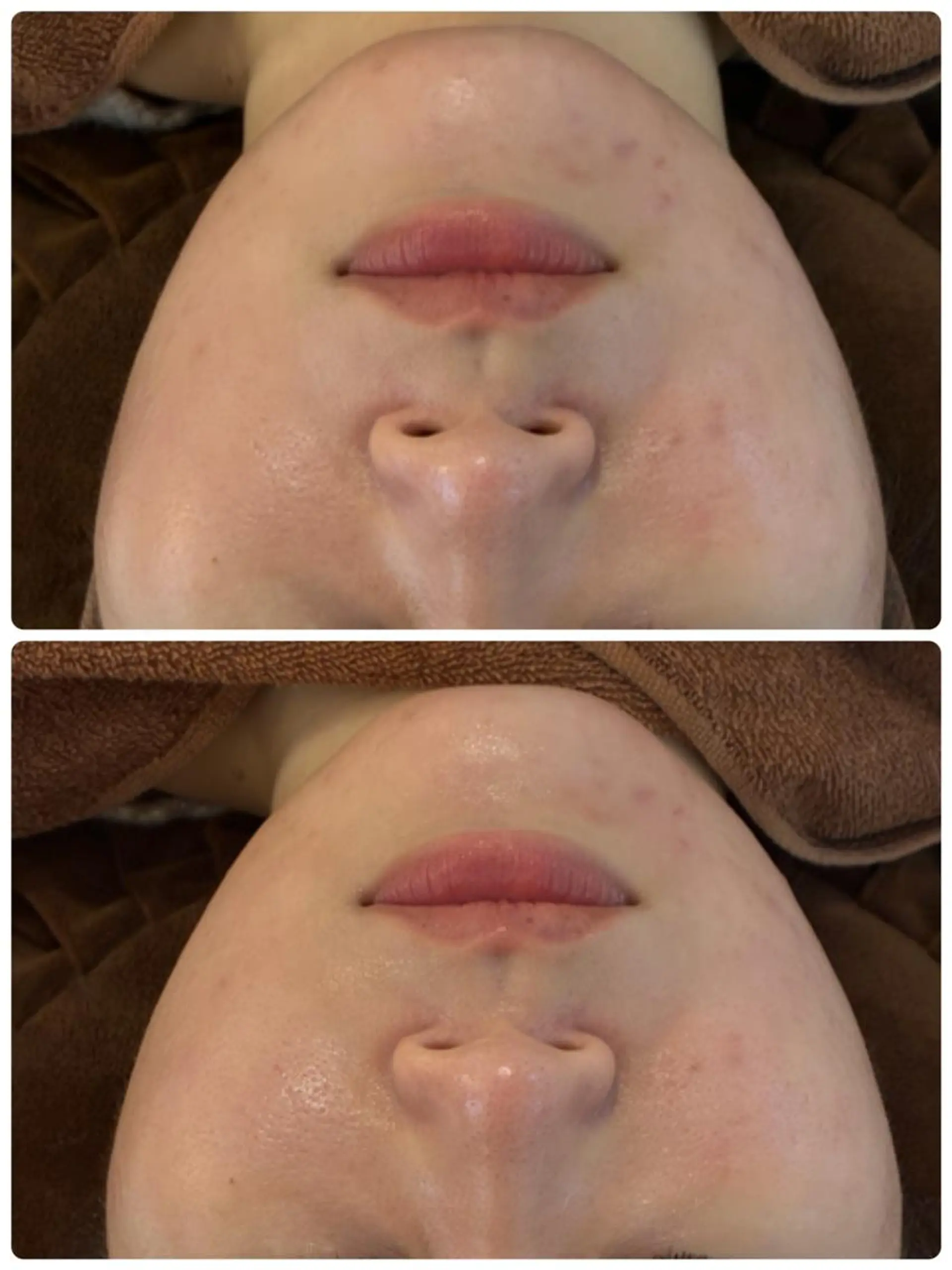 FLEUR🫧 フェイシャルのエステ・リラクイメージ