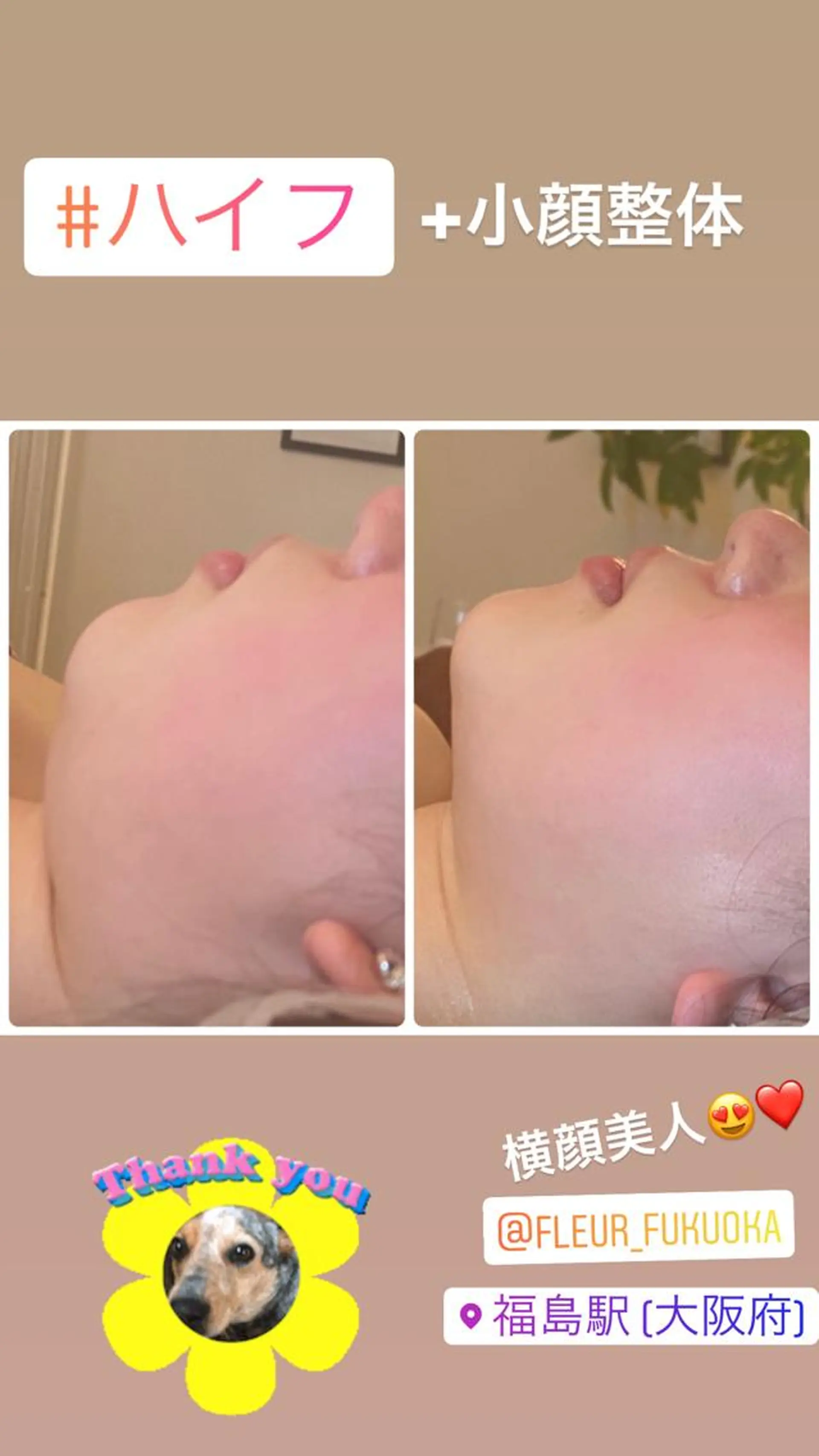 FLEUR大阪・整体 ・ハイフ・痩身・小顔のエステ・リラクイメージ