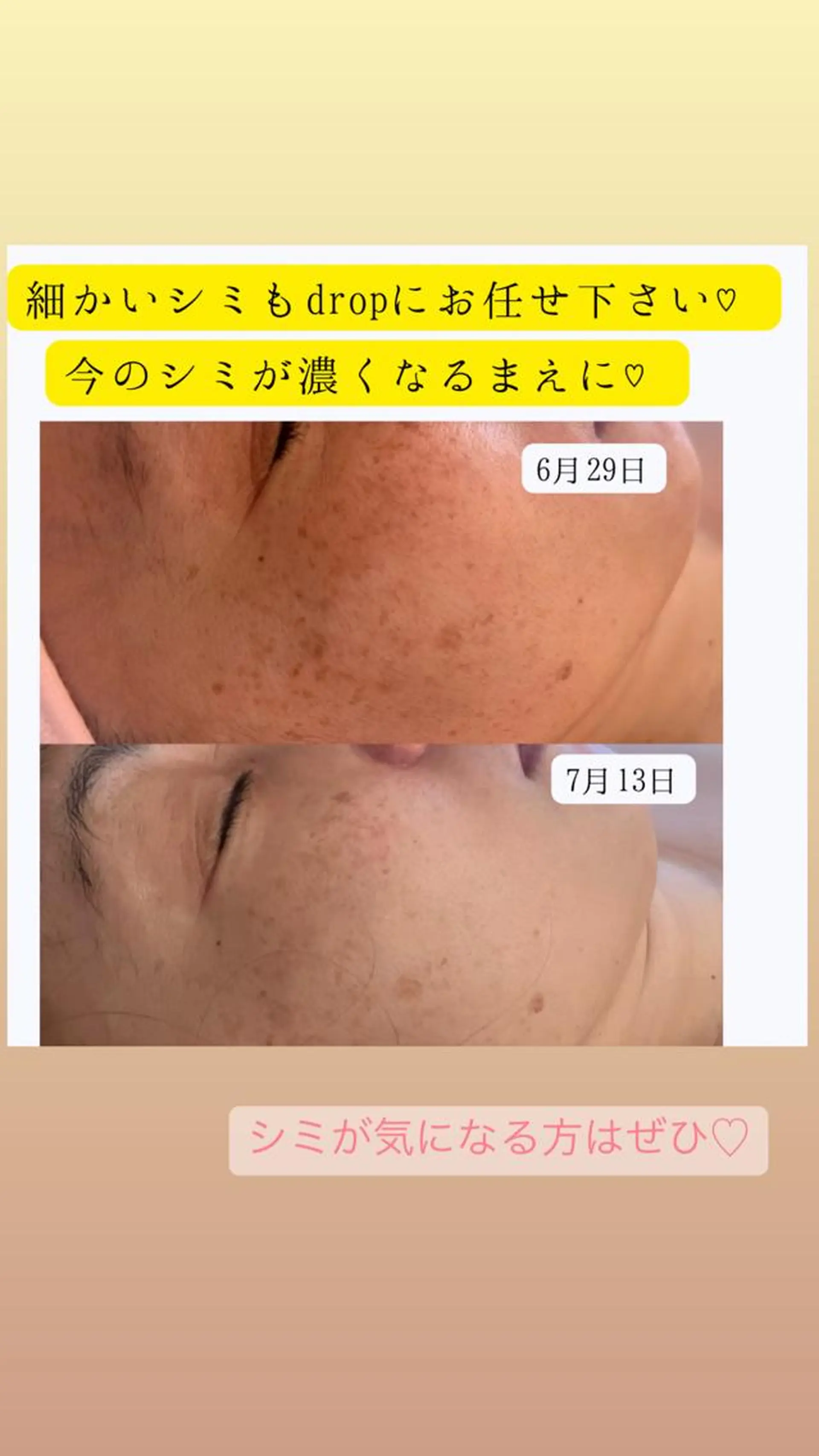 salon＿drop所属・salon dropのエステ・リラクイメージ
