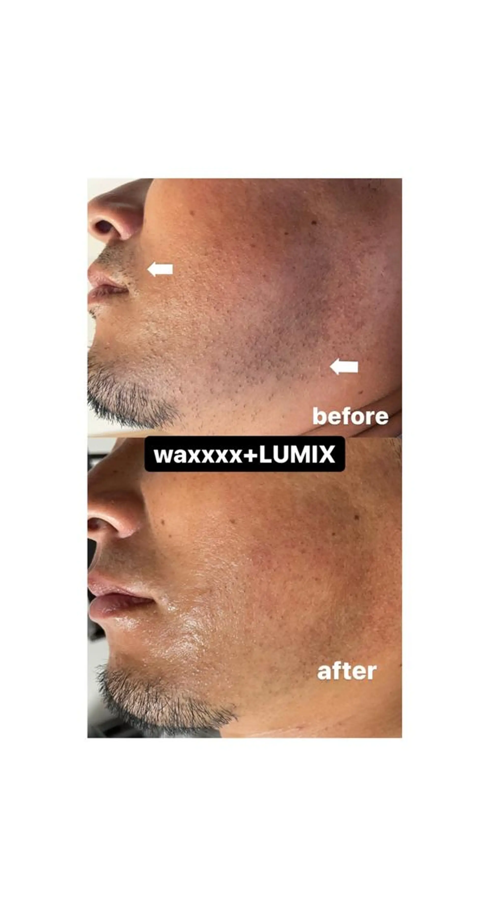 脱毛 Epina 千葉店 【エピナ】のエステ・リラクイメージ