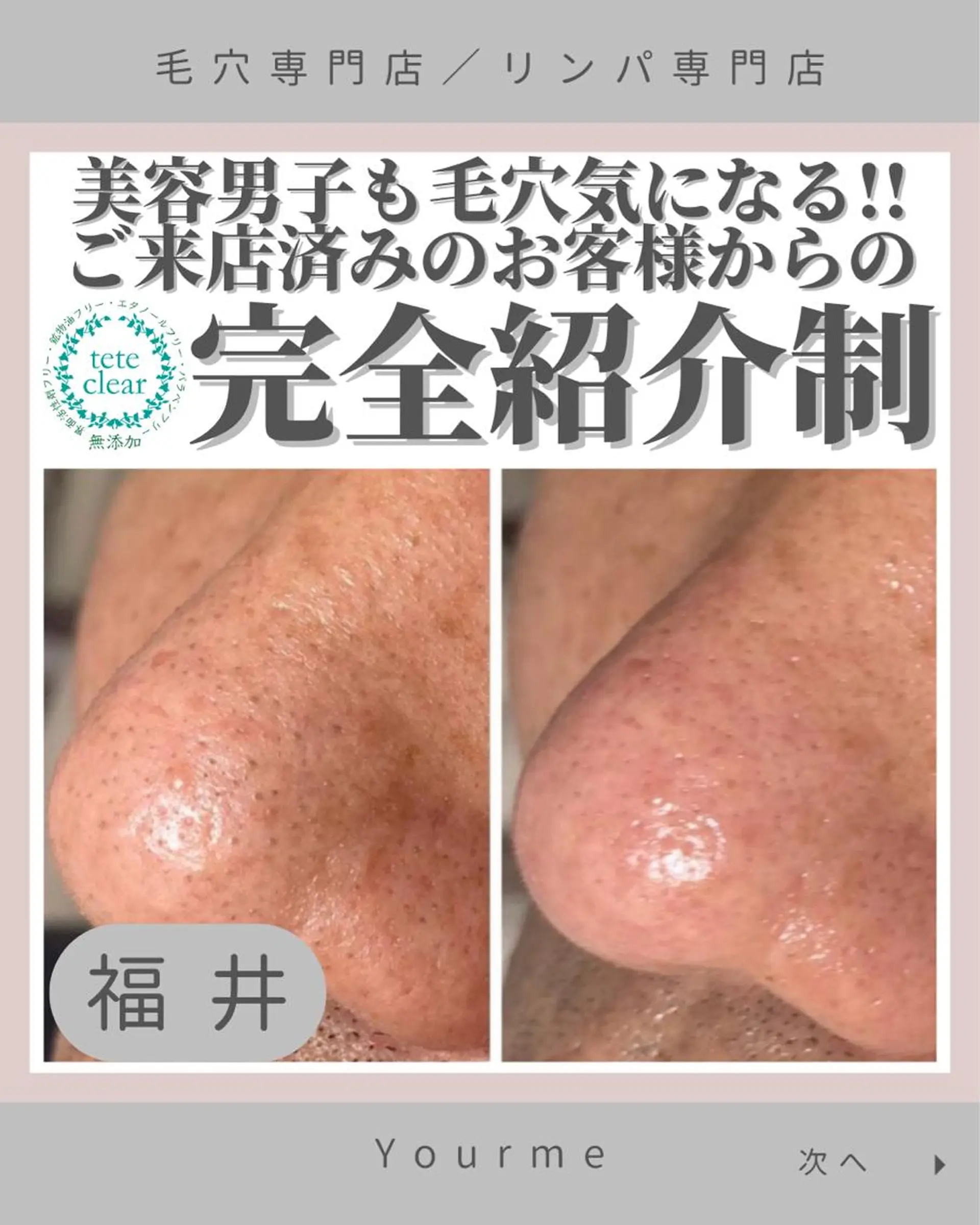 毛穴ケア専門サロン Yourmeユアミーのエステ・リラクイメージ