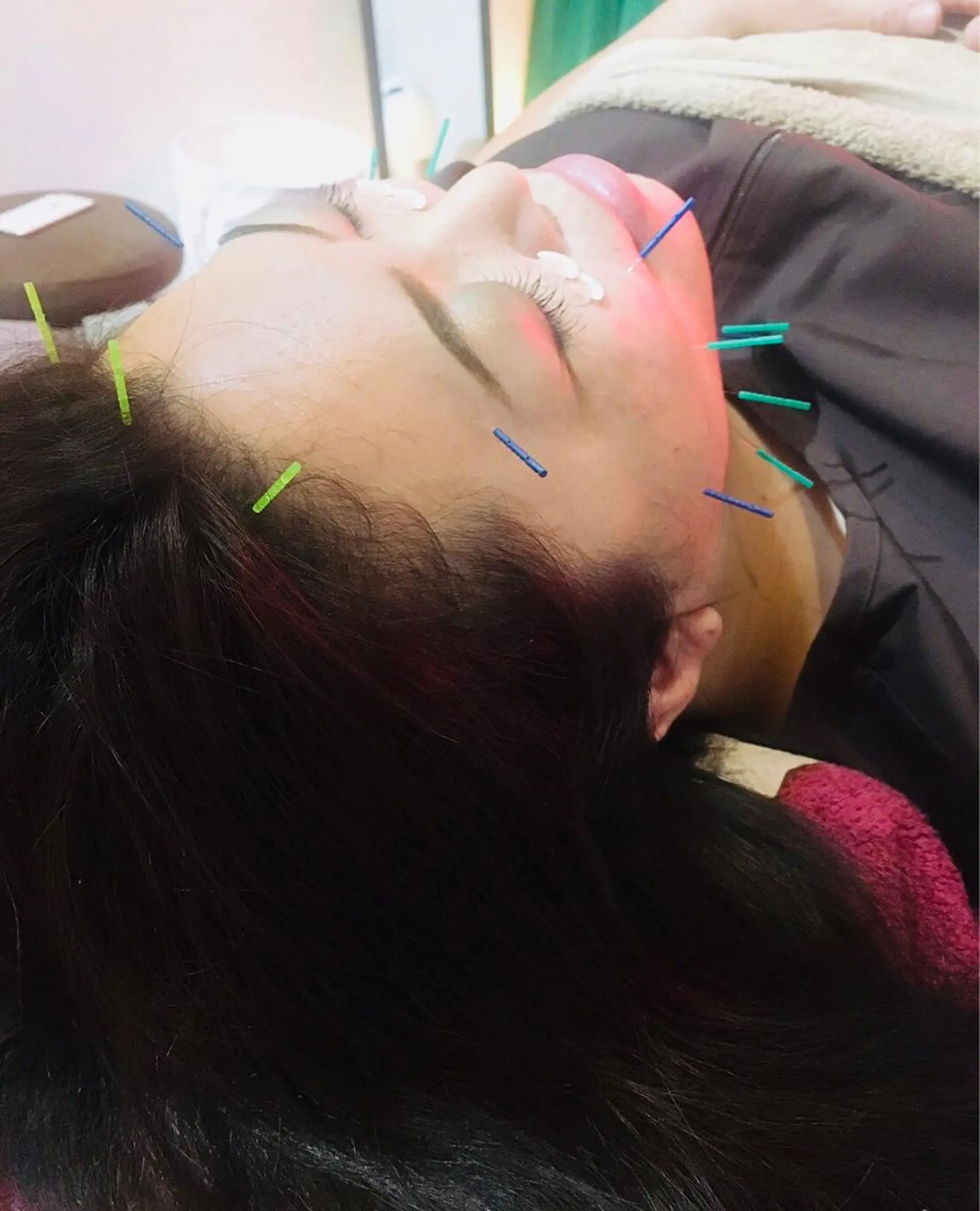 美容鍼灸女性専用 りんご鍼灸治療院のその他イメージ