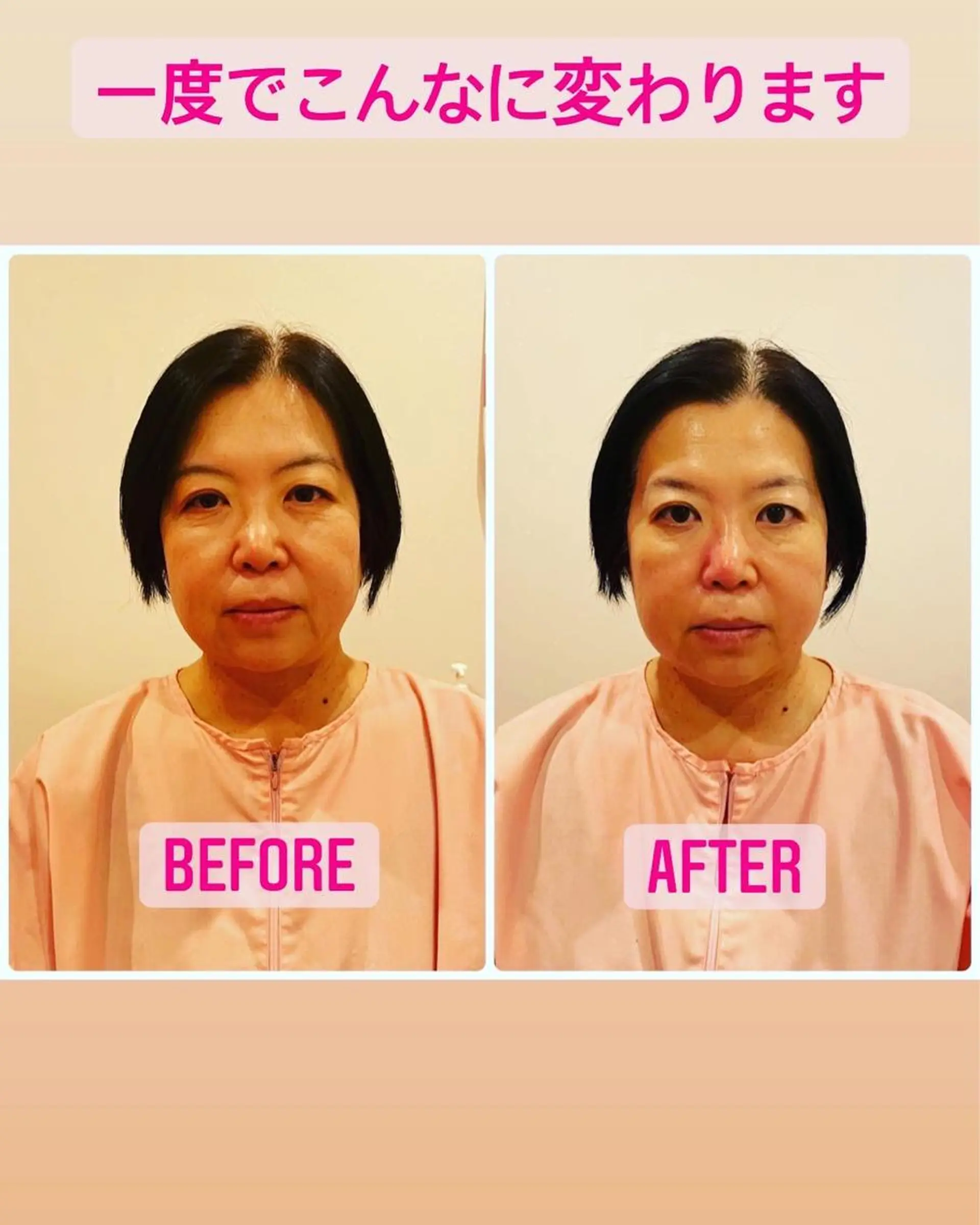 CRAZY NAILのネイルデザイン