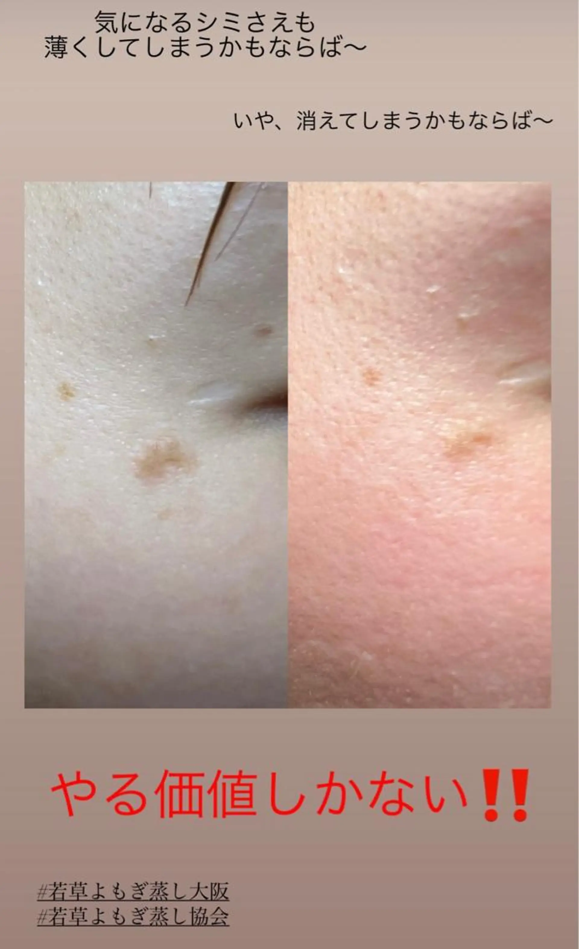 エステ リラク lymph care 'Welnəsのエステ・リラクイメージ