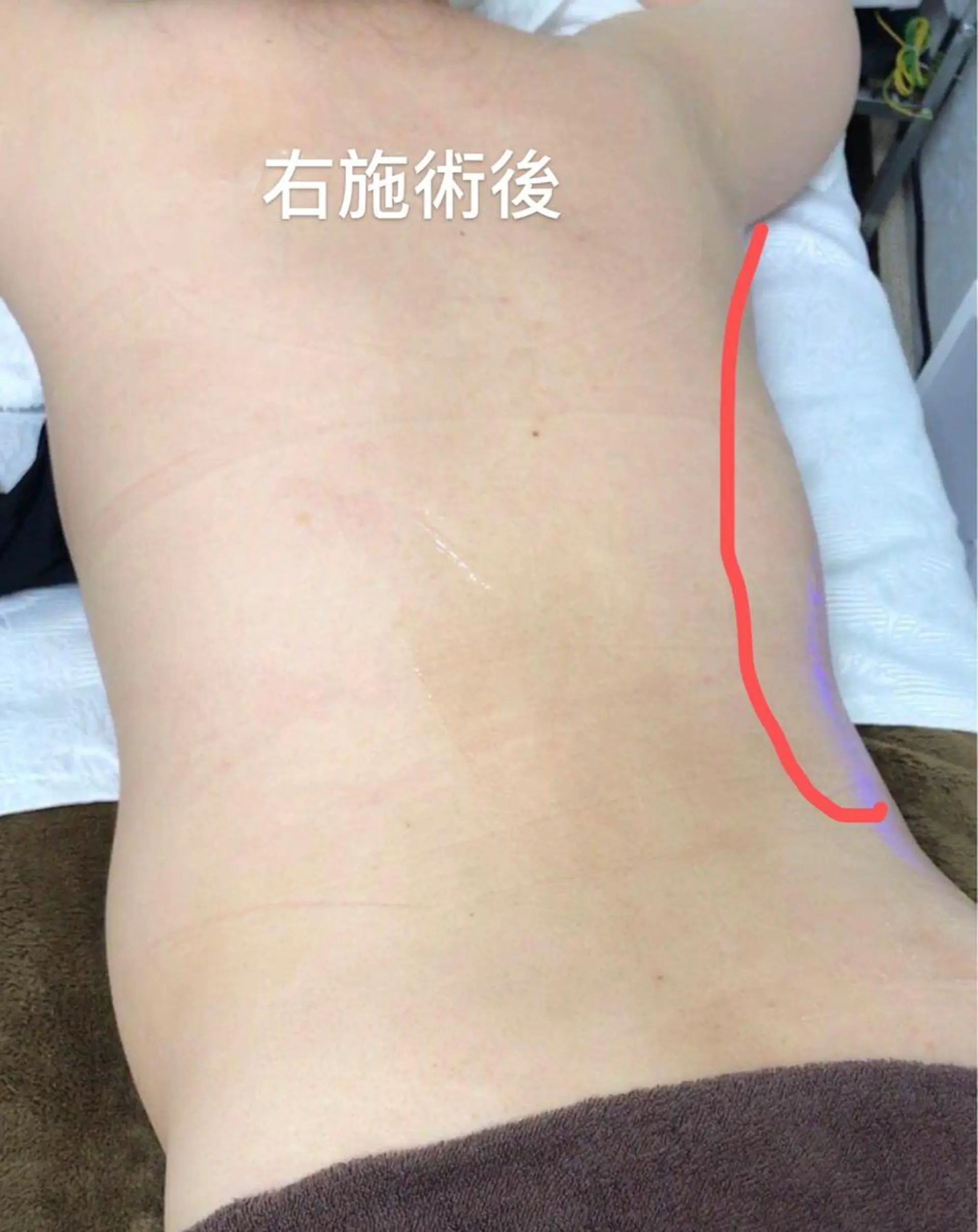 エステ aliaハイフ&水光ジェットサロン所属・aliaハーブ水光店 エステティシャン募集のエステ・リラクイメージ