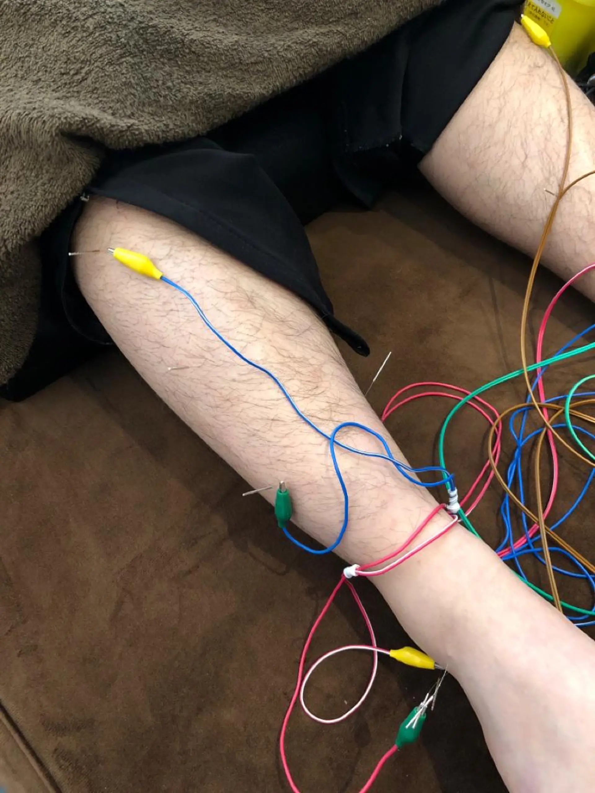 その他 美容鍼灸整体サロンBeauJu所属・小顔矯/美容鍼/鍼灸 BeauJuのその他イメージ