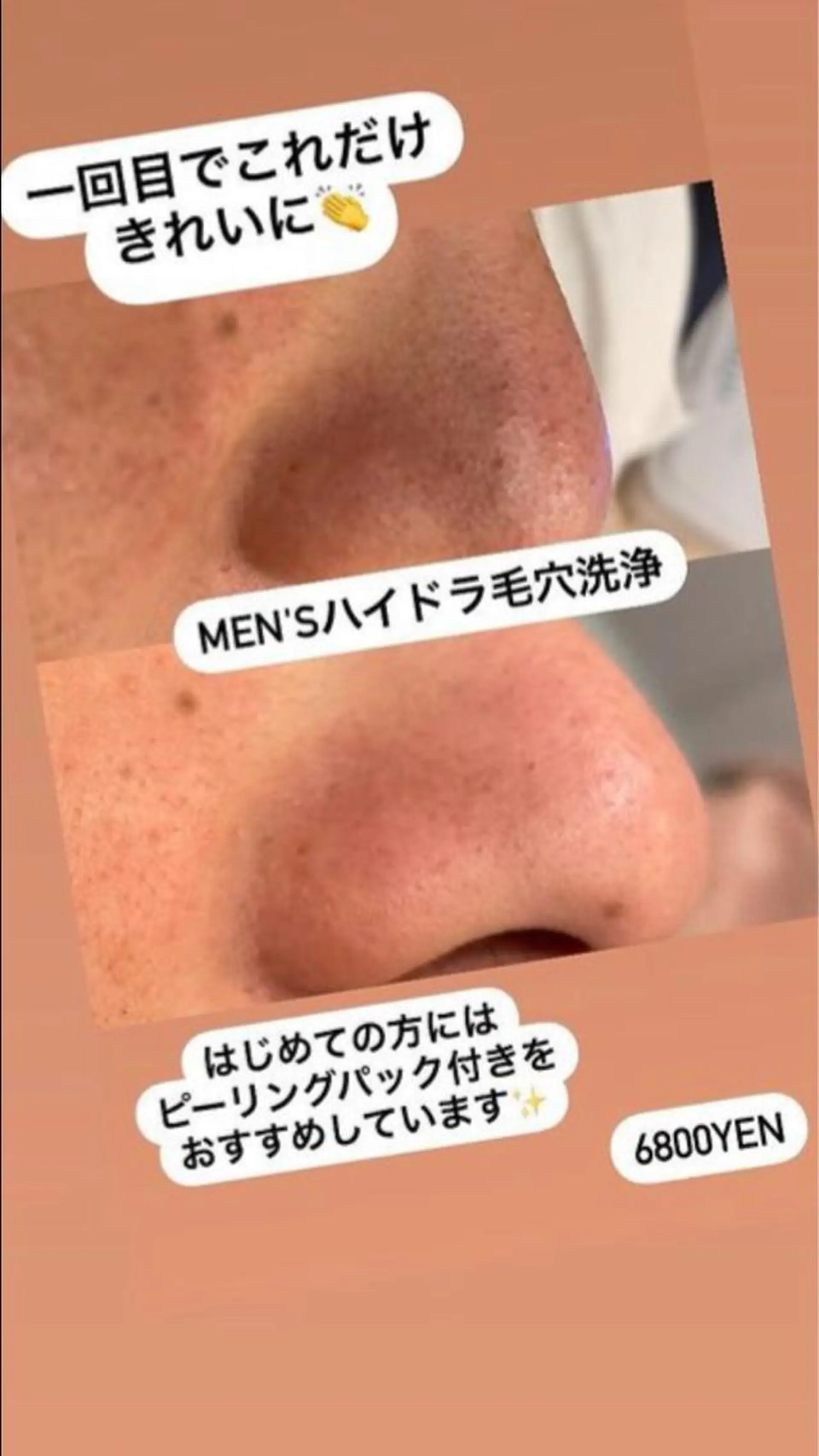 ベルーテ エッセンスのエステ・リラクイメージ