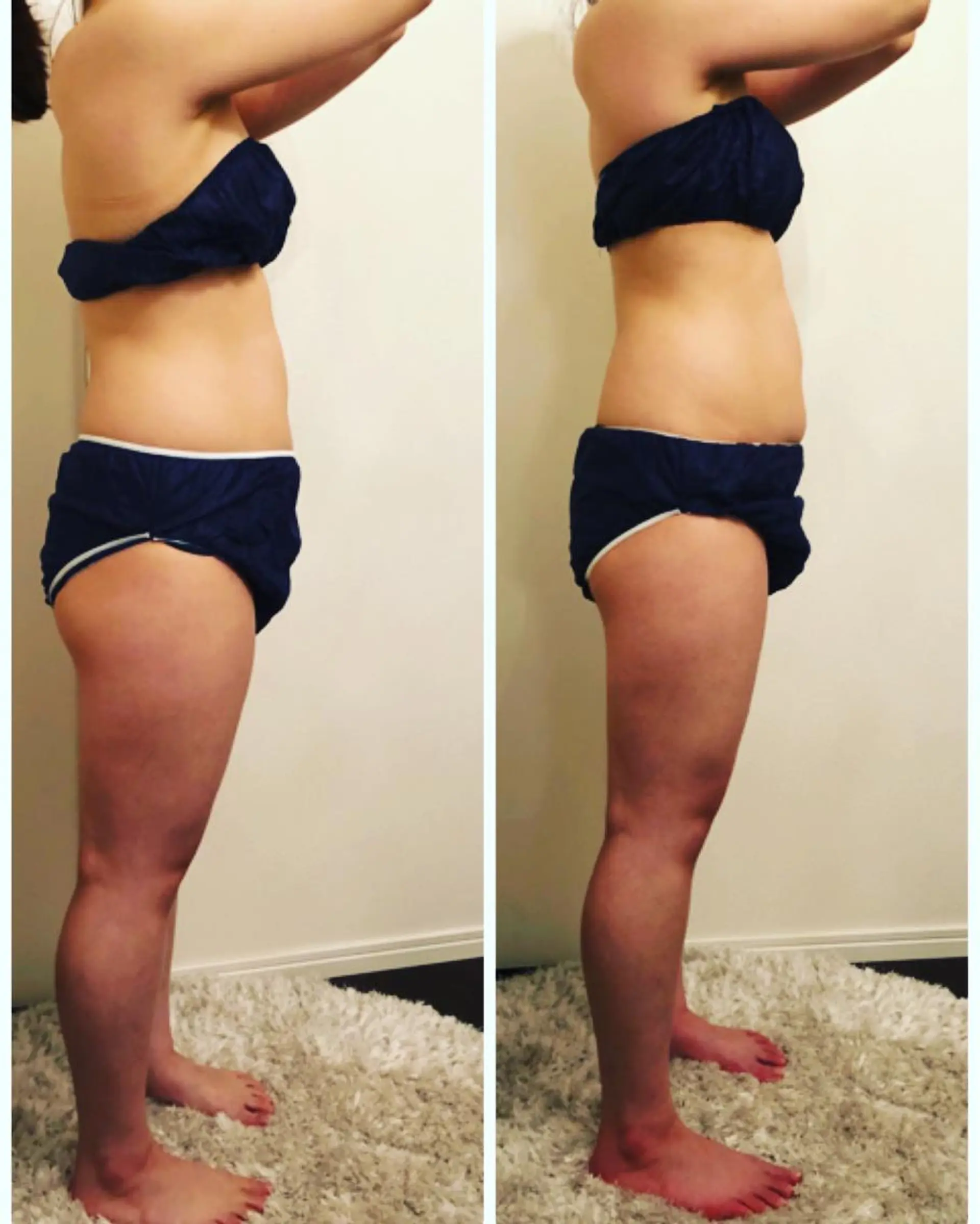 FLEUR大阪・整体 ・ハイフ・痩身・小顔のエステ・リラクイメージ