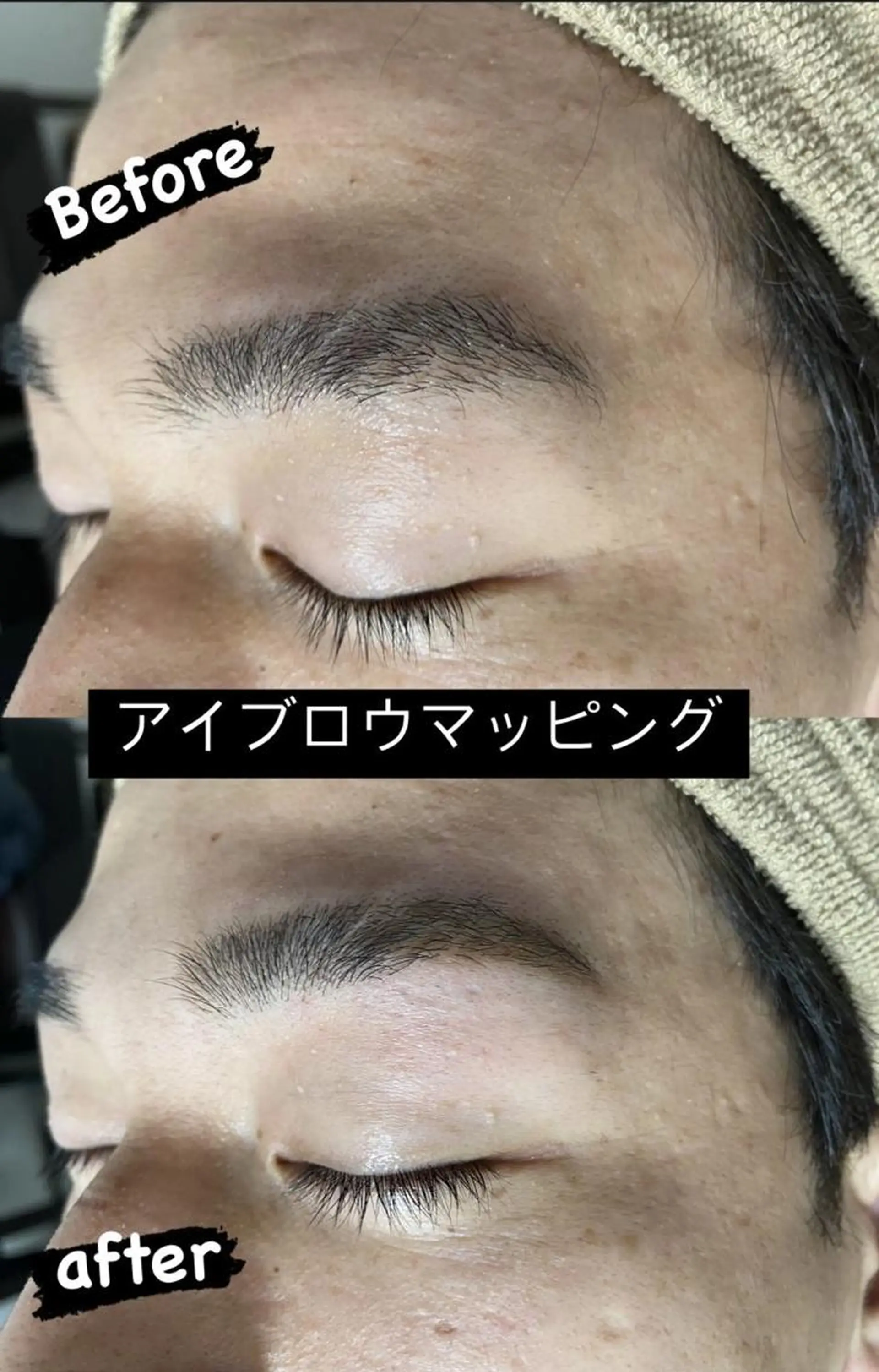 キッズ メンズ ワックス脱毛 Epina 千葉店 【エピナ】のエステ・リラクイメージ