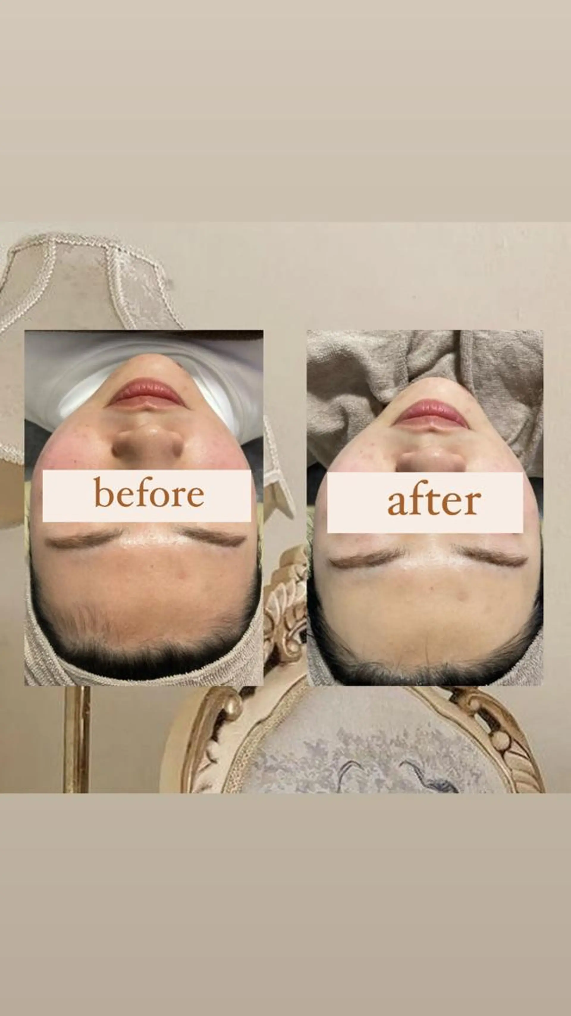 エステ crescent所属・【韓国肌管理・脱毛】 クレセントのエステ・リラクイメージ