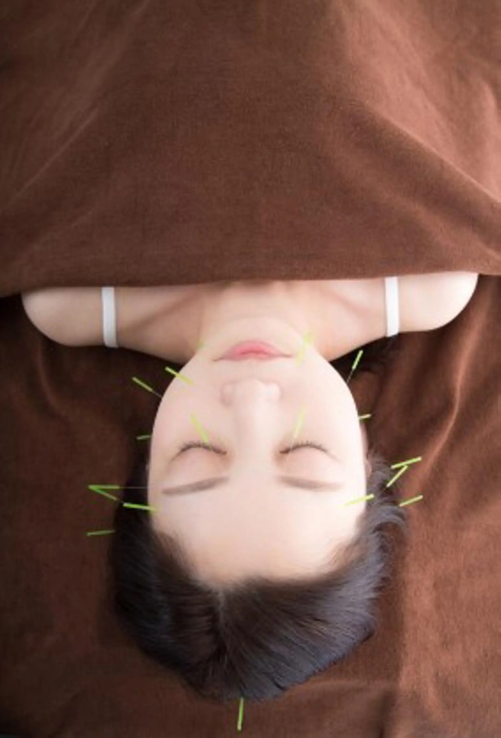 Acupuncture  salon LINOA リノア鍼灸院所属・ヘッドスパ鍼/小顔鍼 耳ツボ 　LINOAのエステ・リラクイメージ