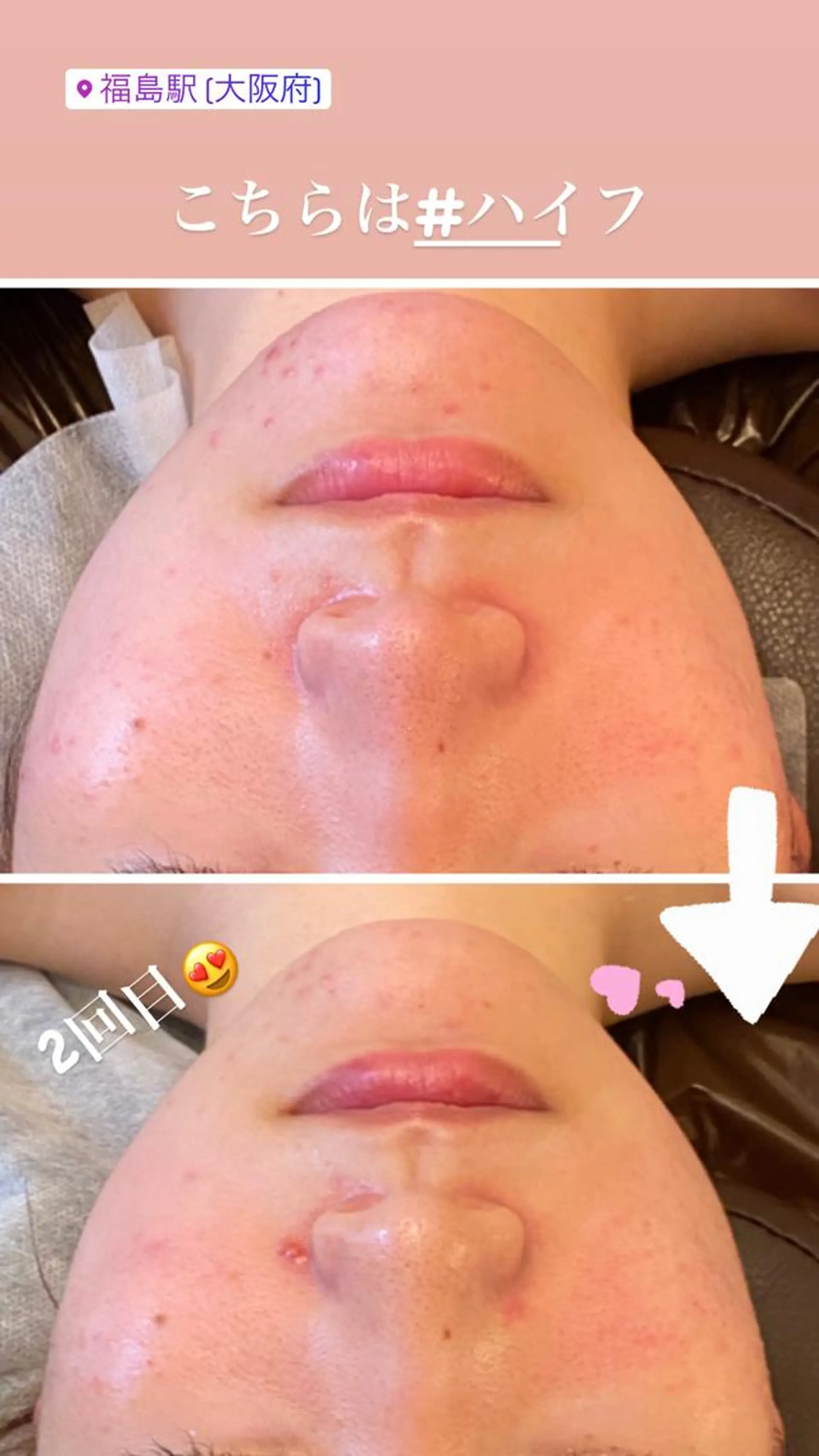 FLEUR大阪・整体 ・ハイフ・痩身・小顔のエステ・リラクイメージ