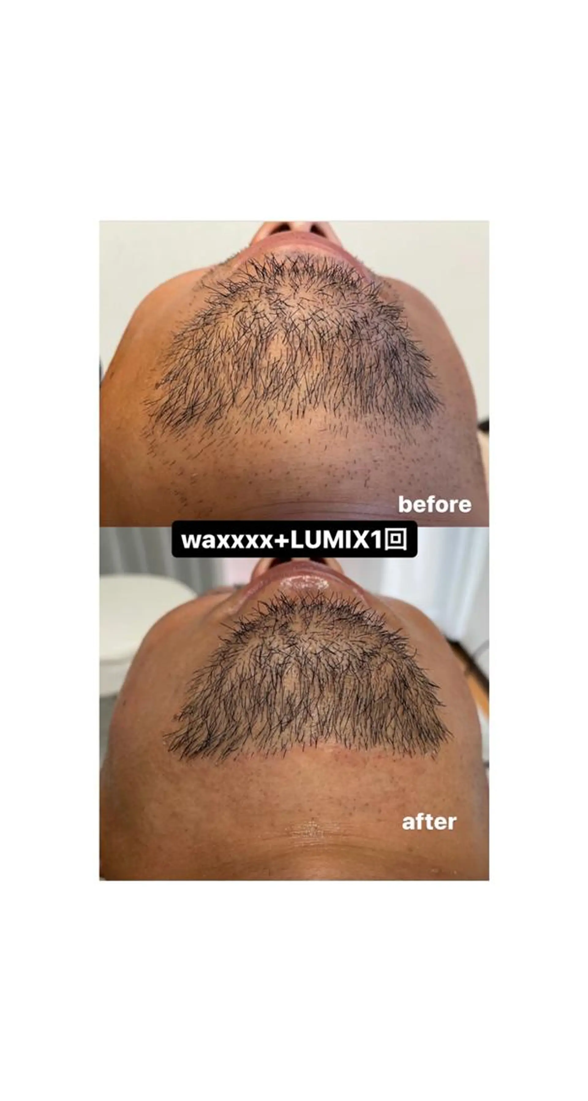 脱毛 Epina 千葉店 【エピナ】のエステ・リラクイメージ