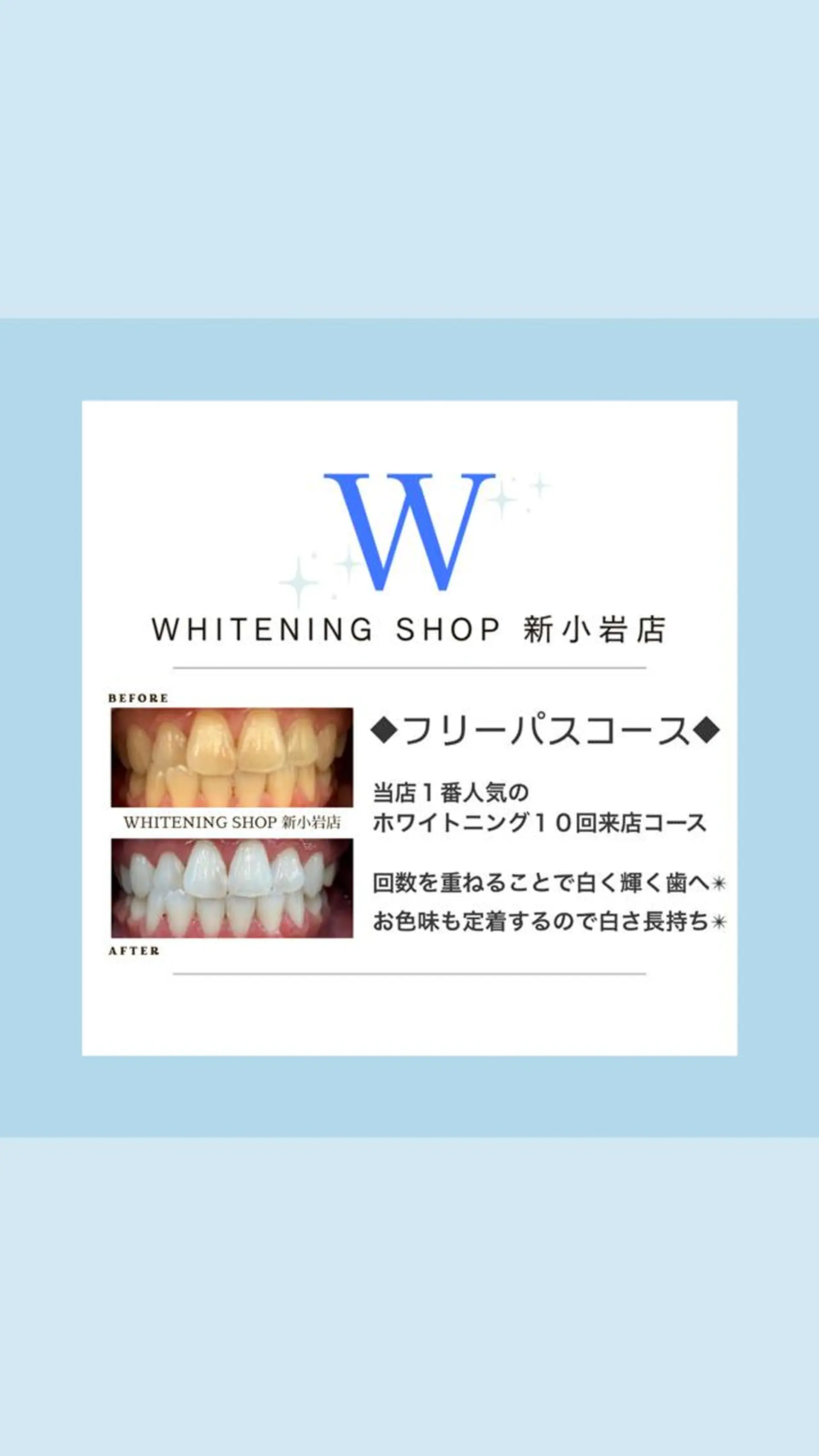 ホワイトニング ショップ新小岩店のその他イメージ