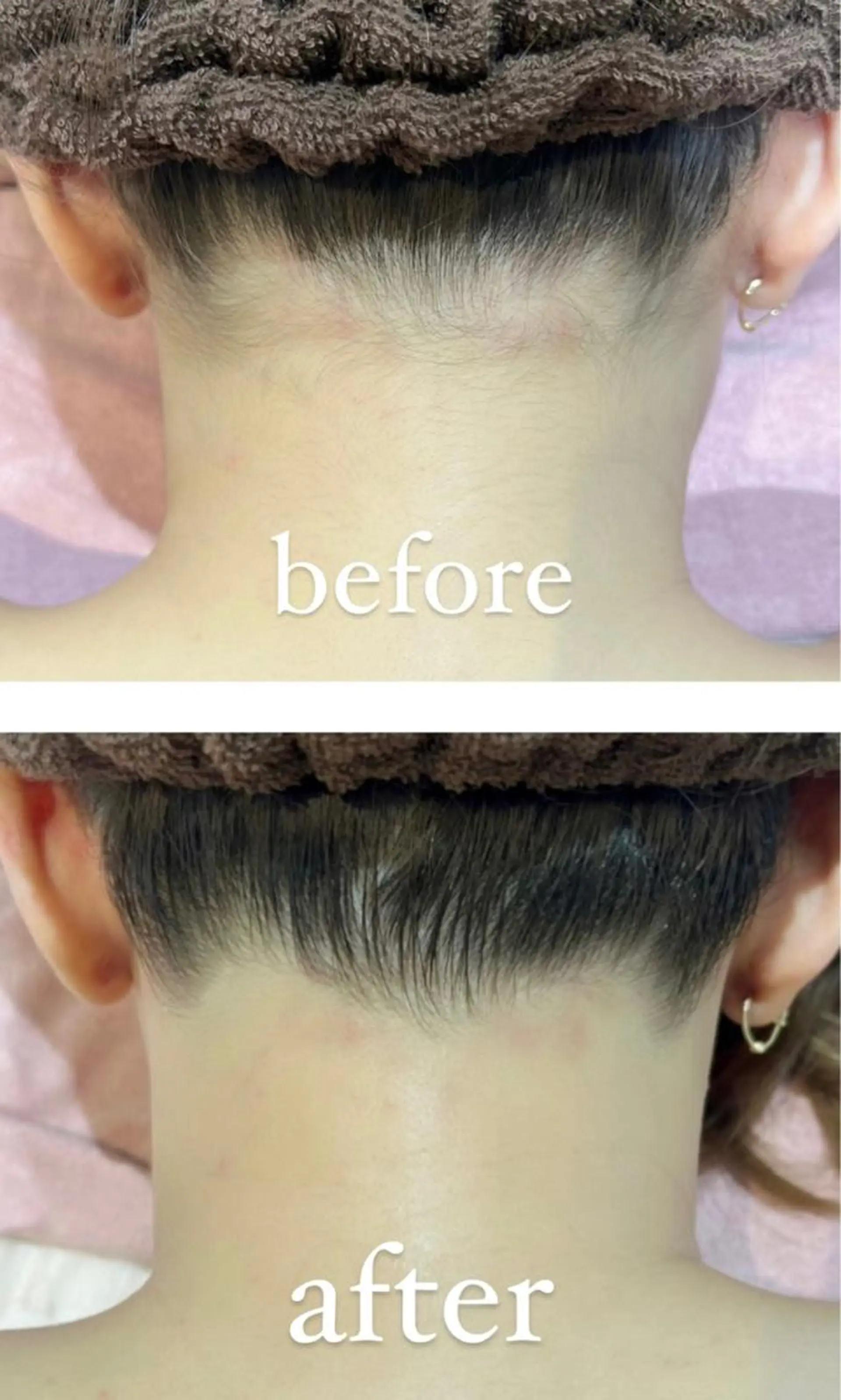 RAY Beauty エステ 一宮店のエステ・リラクイメージ