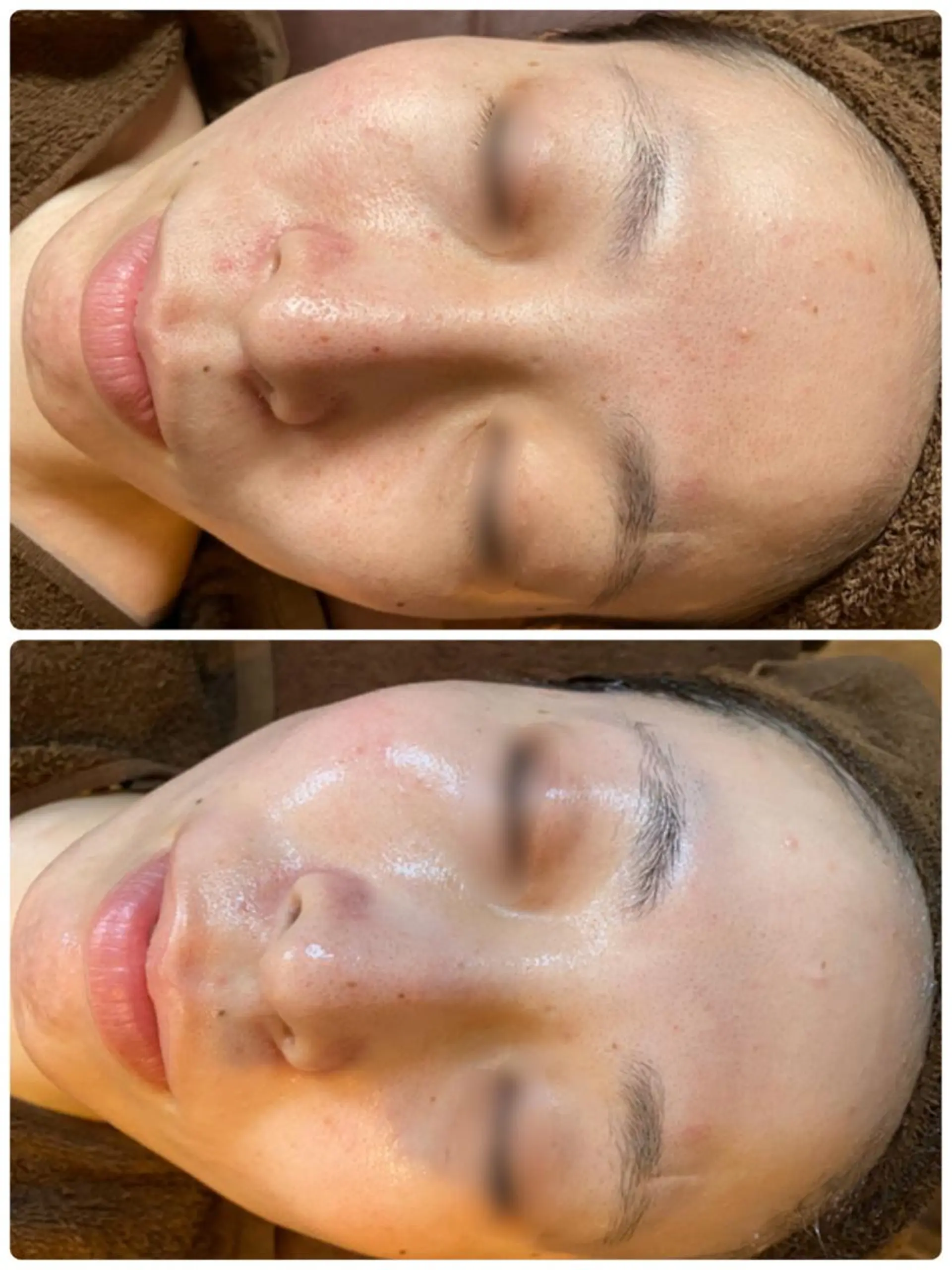 エステ cocorire インターパークの眉毛・アイブロウイメージ