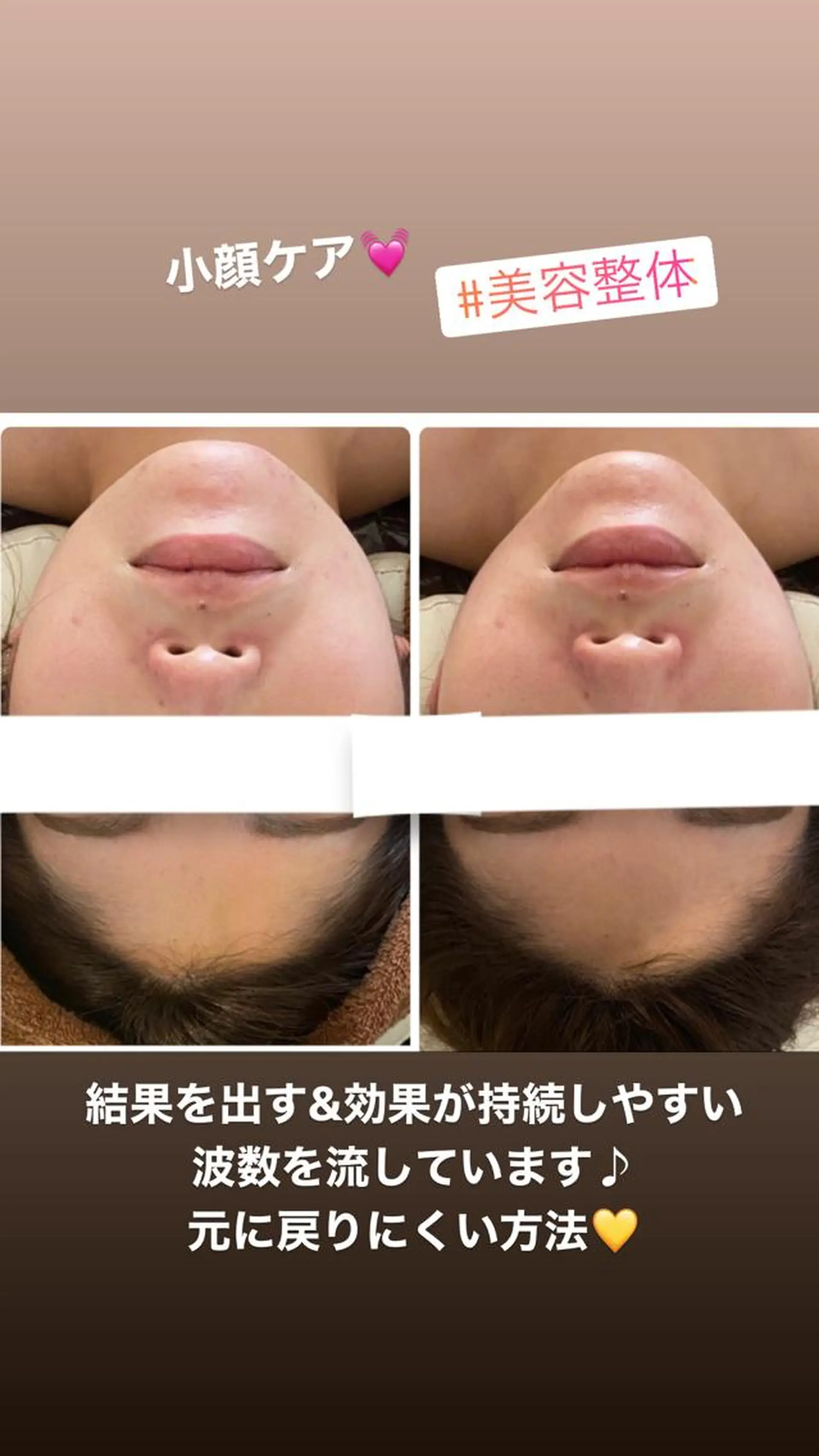 FLEUR大阪・整体 ・ハイフ・痩身・小顔のエステ・リラクイメージ