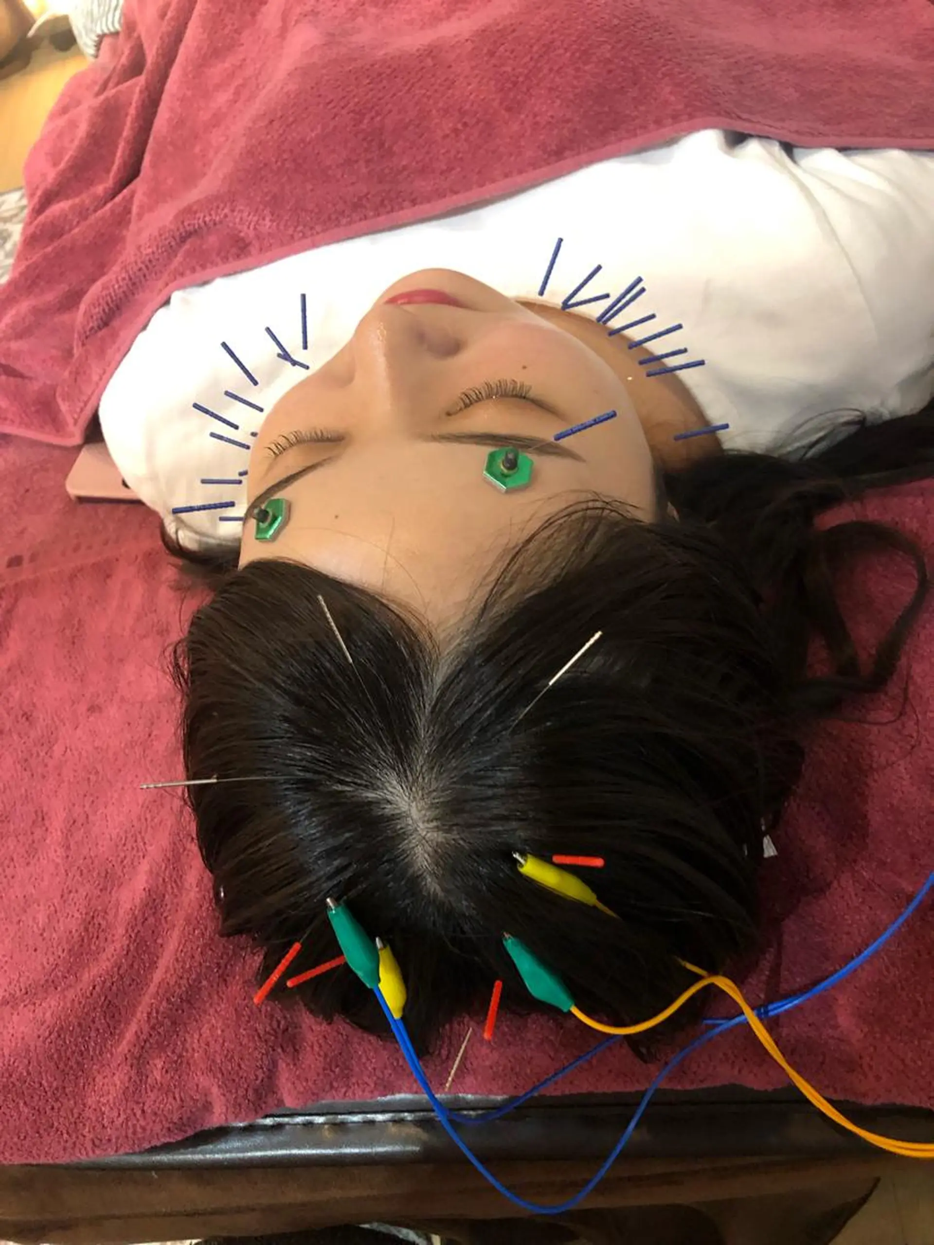 エステ リラク 美容鍼灸女性専用 りんご鍼灸治療院のその他イメージ