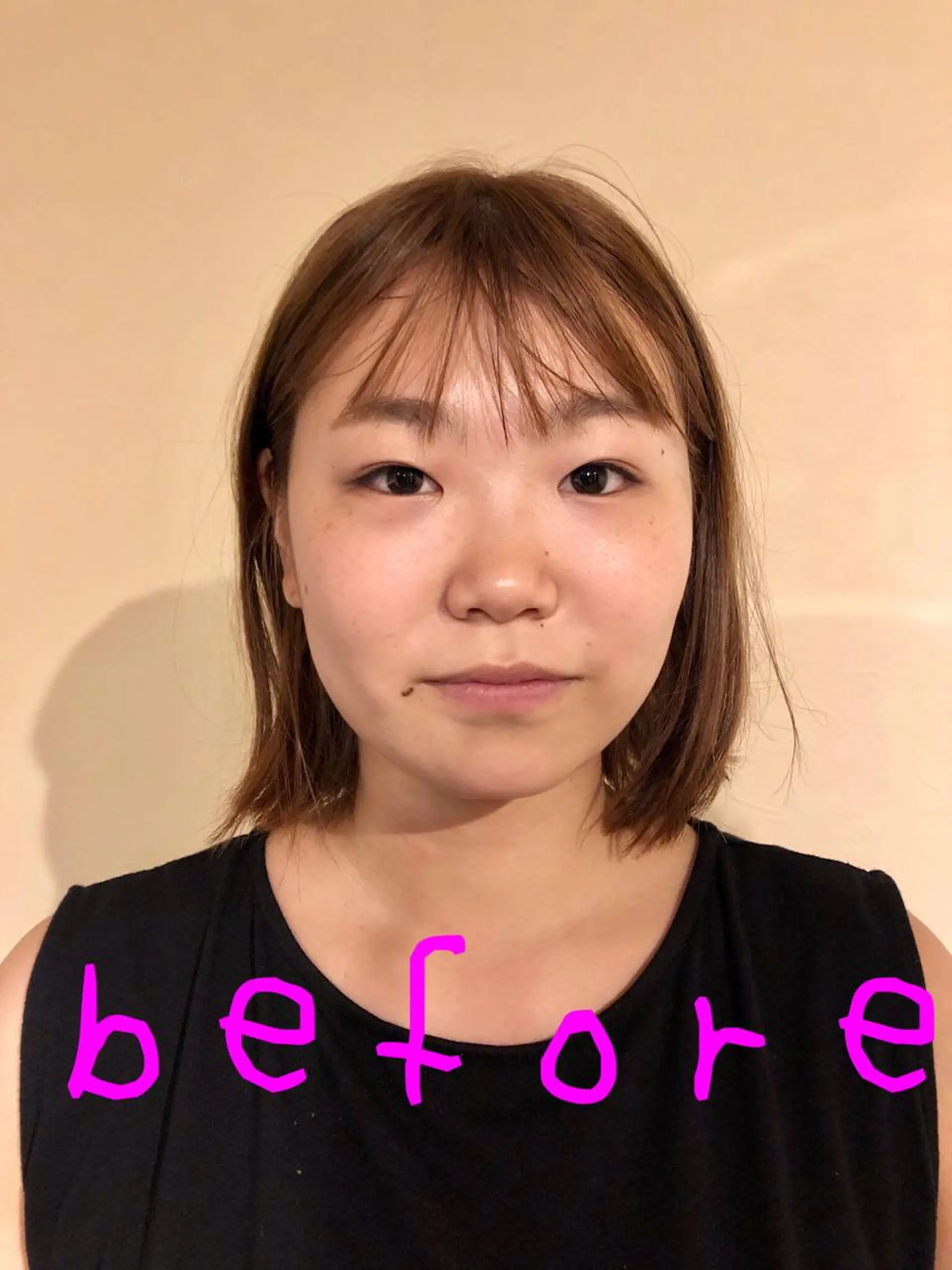 Acupuncture  salon LINOA リノア鍼灸院所属・ヘッドスパ鍼/小顔鍼 耳ツボ 　LINOAのエステ・リラクイメージ