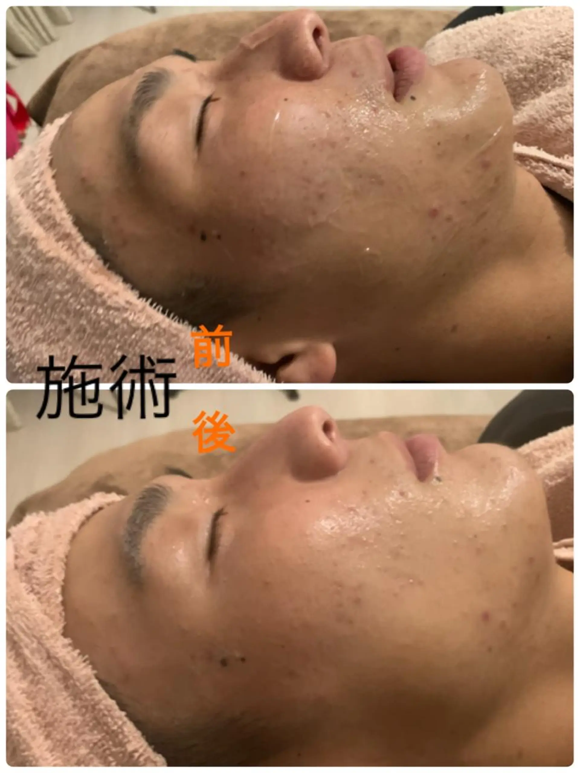 Beauty Salon Mirei所属・Beauty SalonMireiのエステ・リラクイメージ