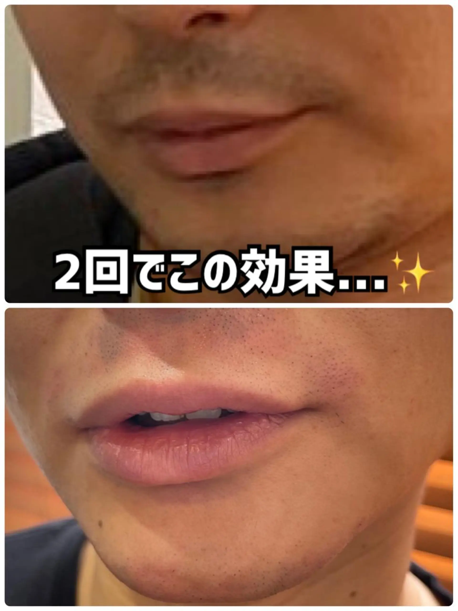 メンズ脱毛サロン マンモス所属・メンズ脱毛サロン マンモス【都度OK】のエステ・リラクイメージ