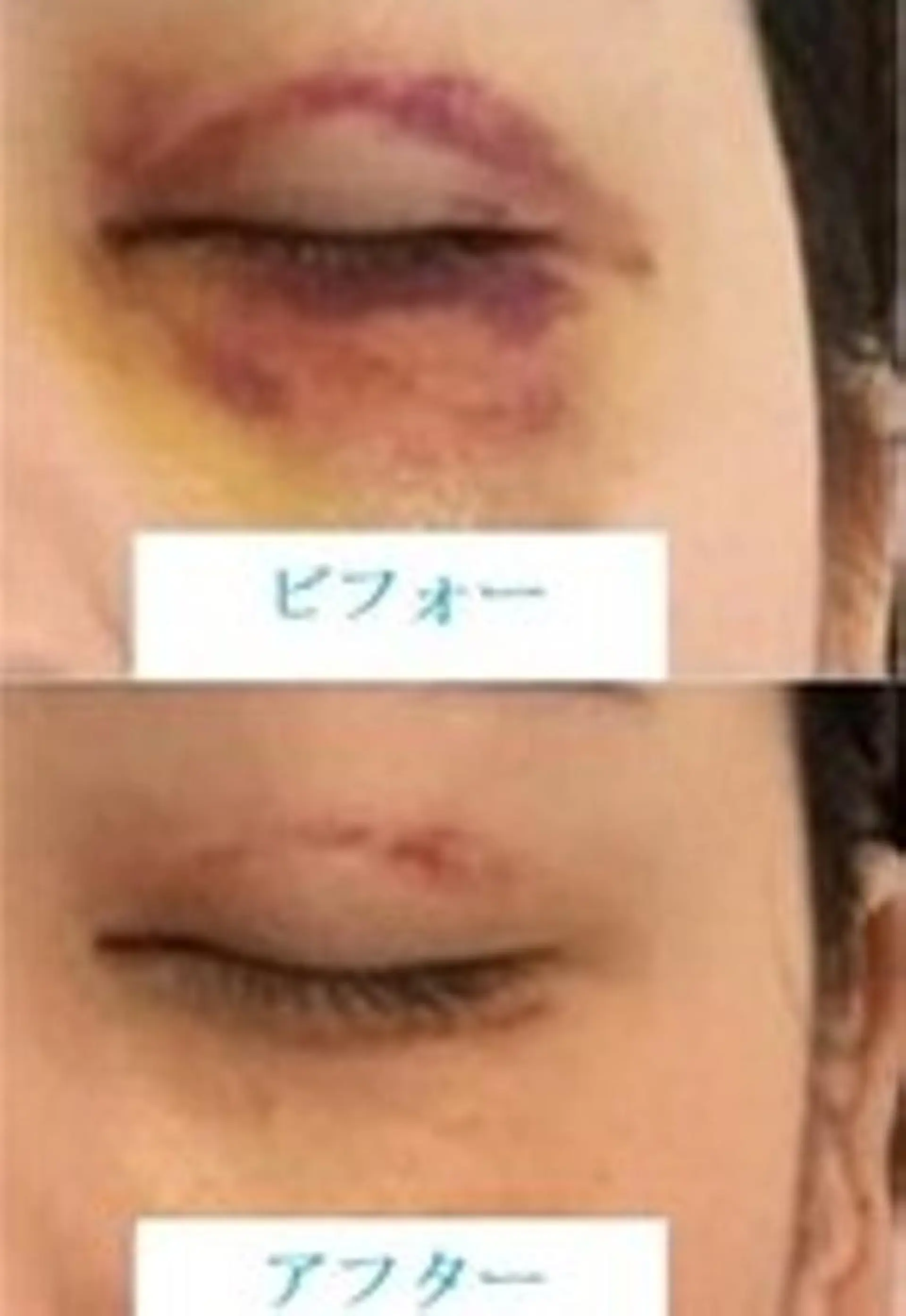 美容術前術後ケア＆ 予防美容ツインズのエステ・リラクイメージ