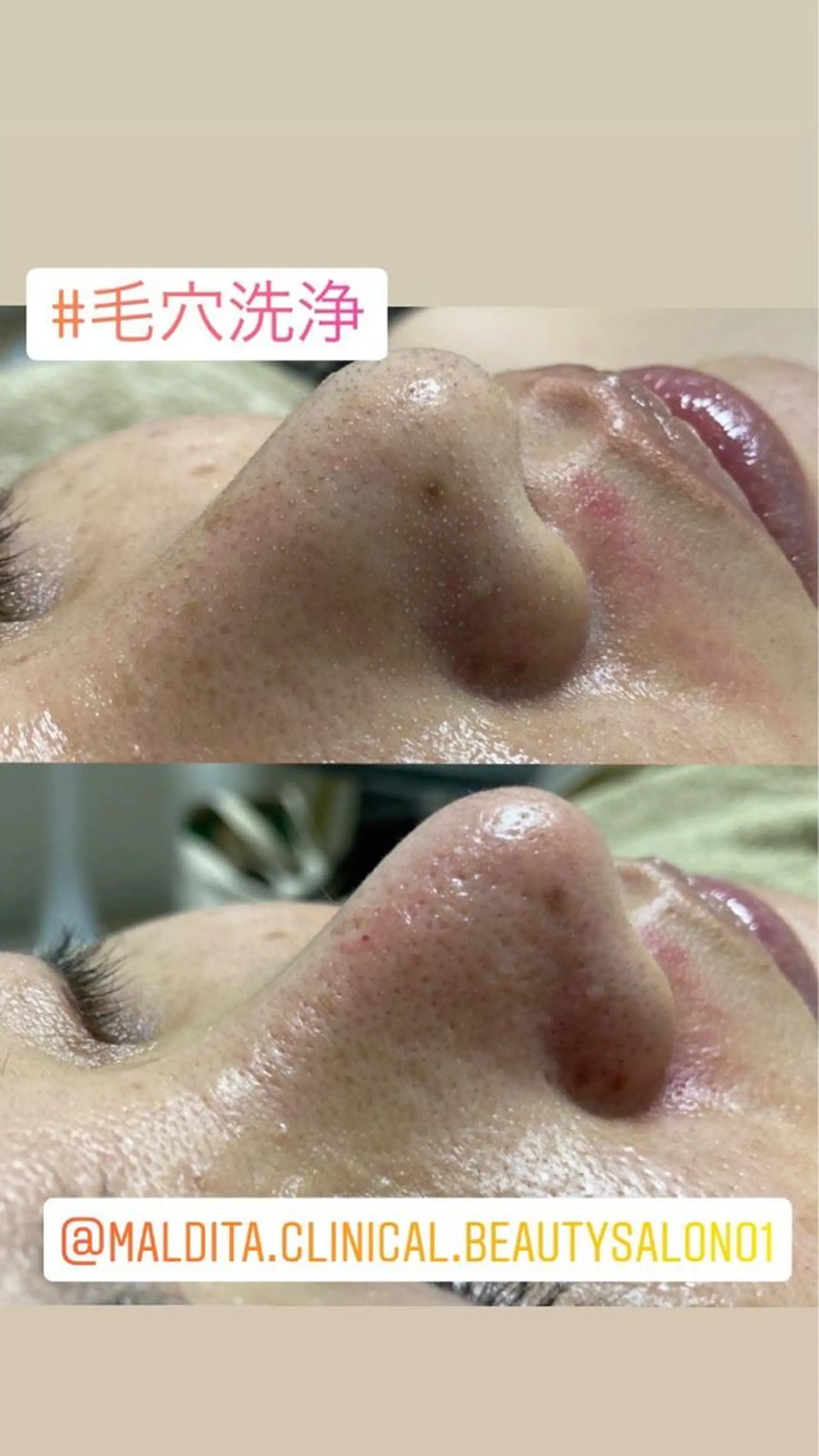 ロング カラー パーマ ヘアアレンジ メンズ マツエク・マツパ 毛穴，ニキビ跡 改善総合サロンのその他イメージ