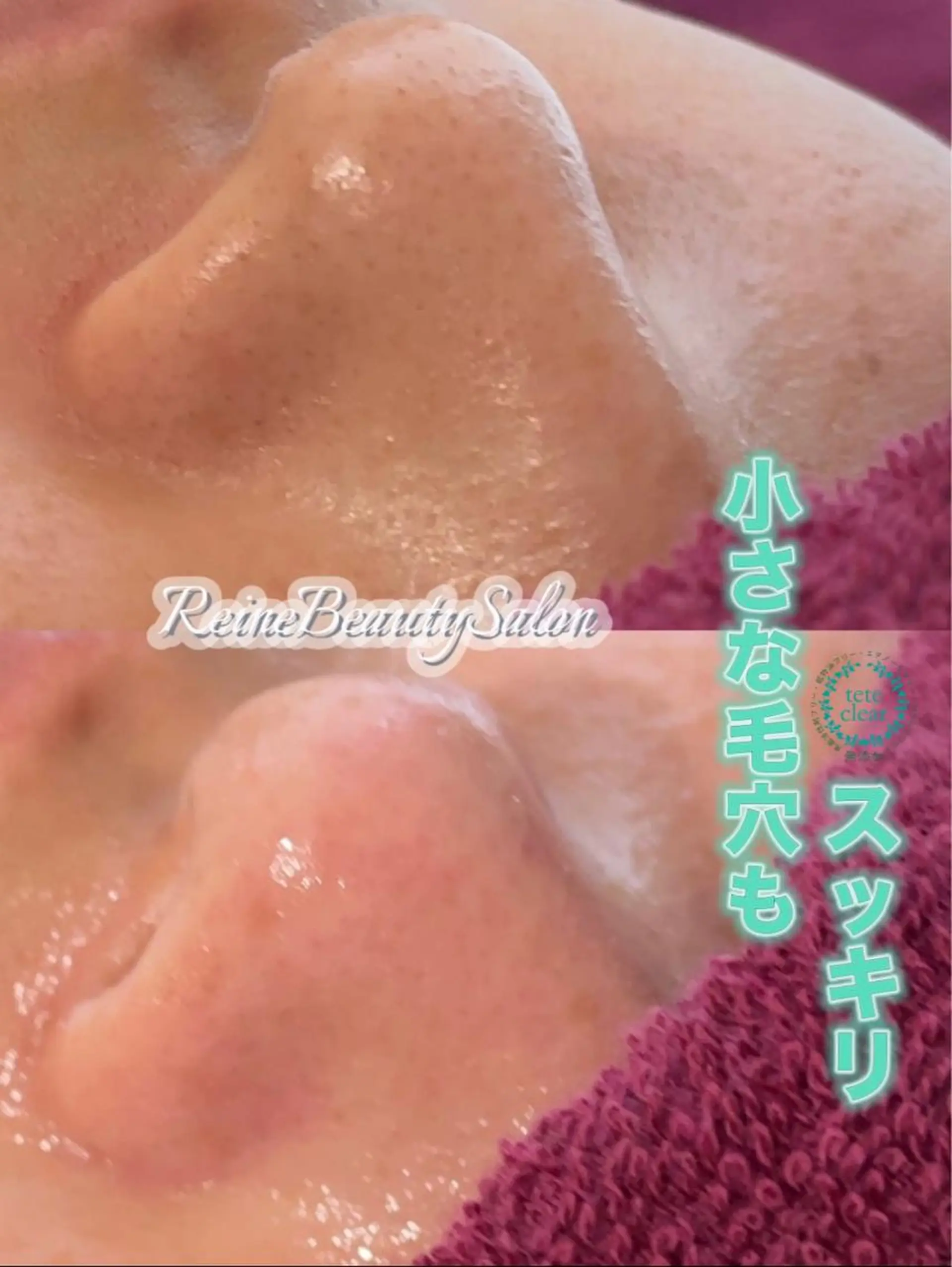 エステ Reine BeautySalon所属・毛穴/シミ肝斑/脱毛 横山梨里のエステ・リラクイメージ
