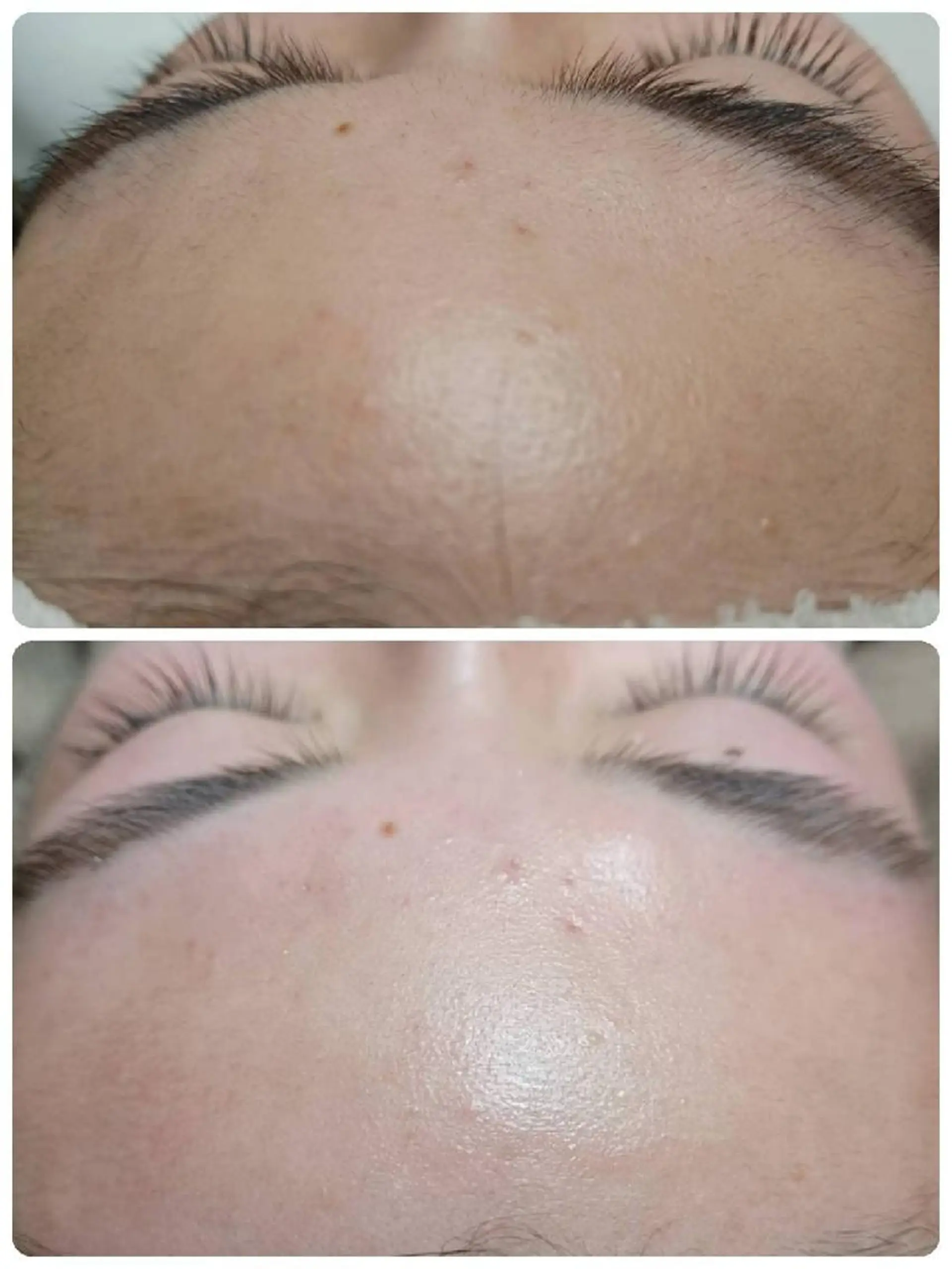 Lutella所属・ワックス脱毛専門店 Lutellaのエステ・リラクイメージ