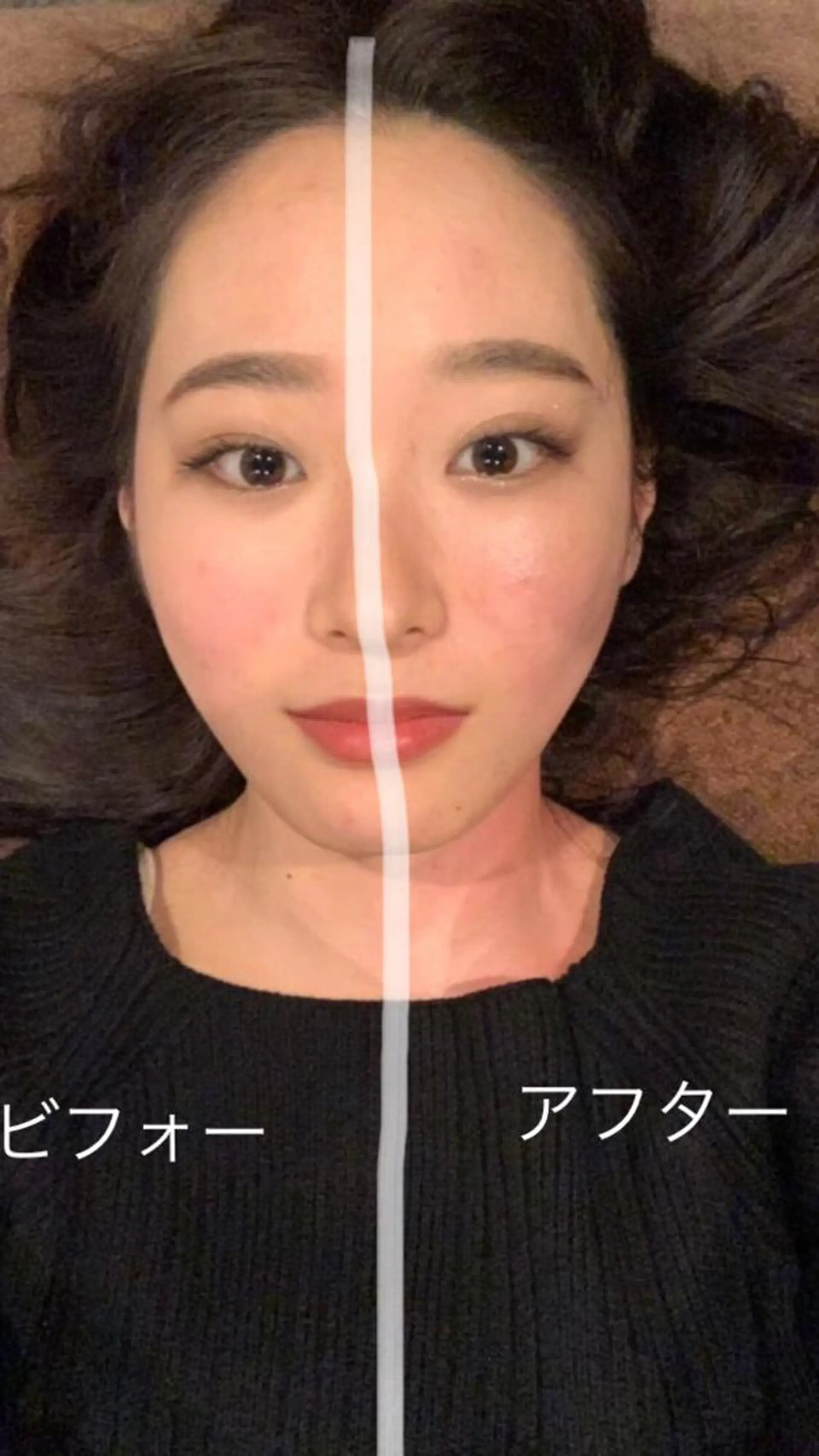 美容鍼灸サロン LOMIHARIのエステ・リラクイメージ