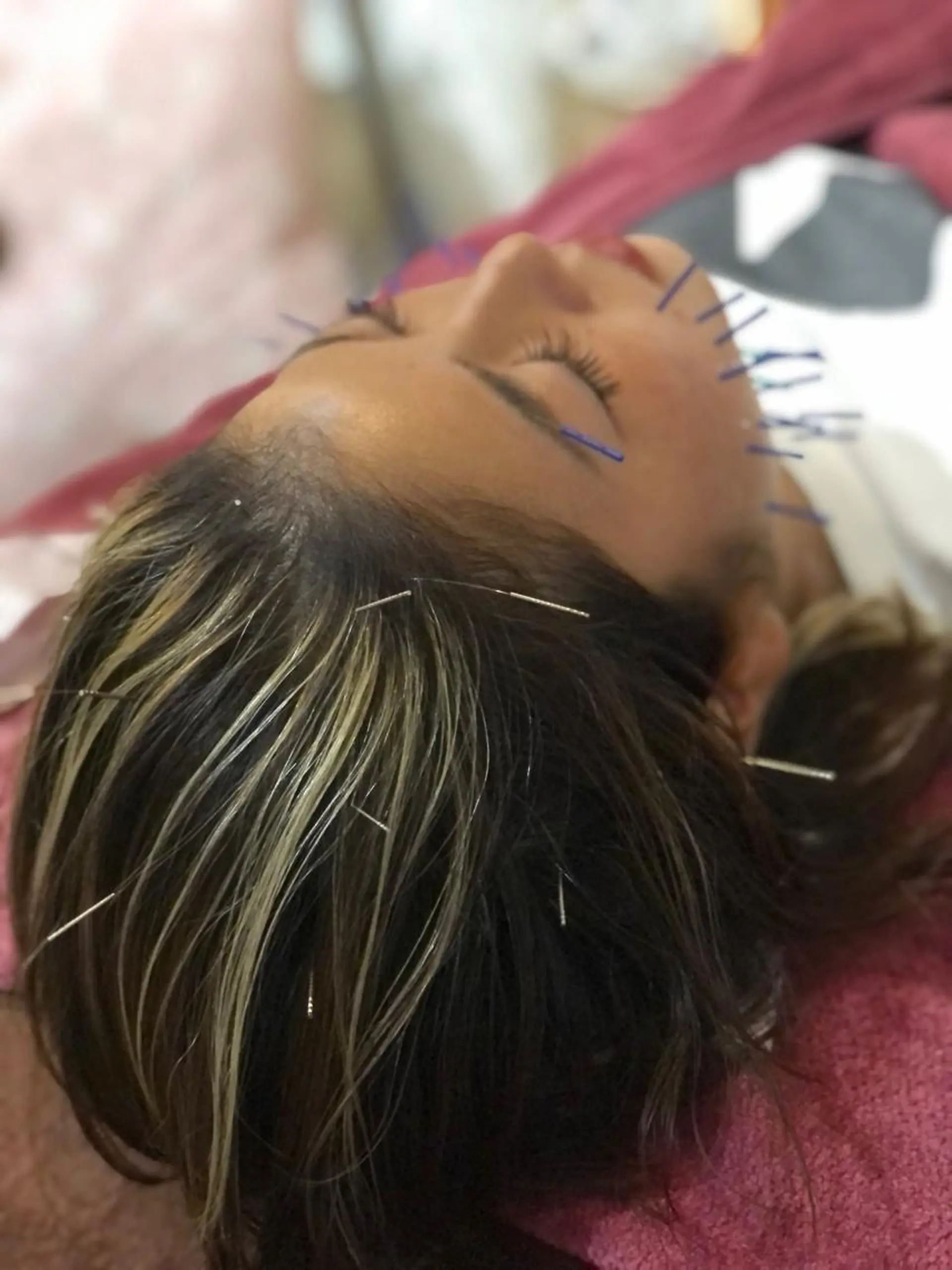 美容鍼灸女性専用 りんご鍼灸治療院のその他イメージ